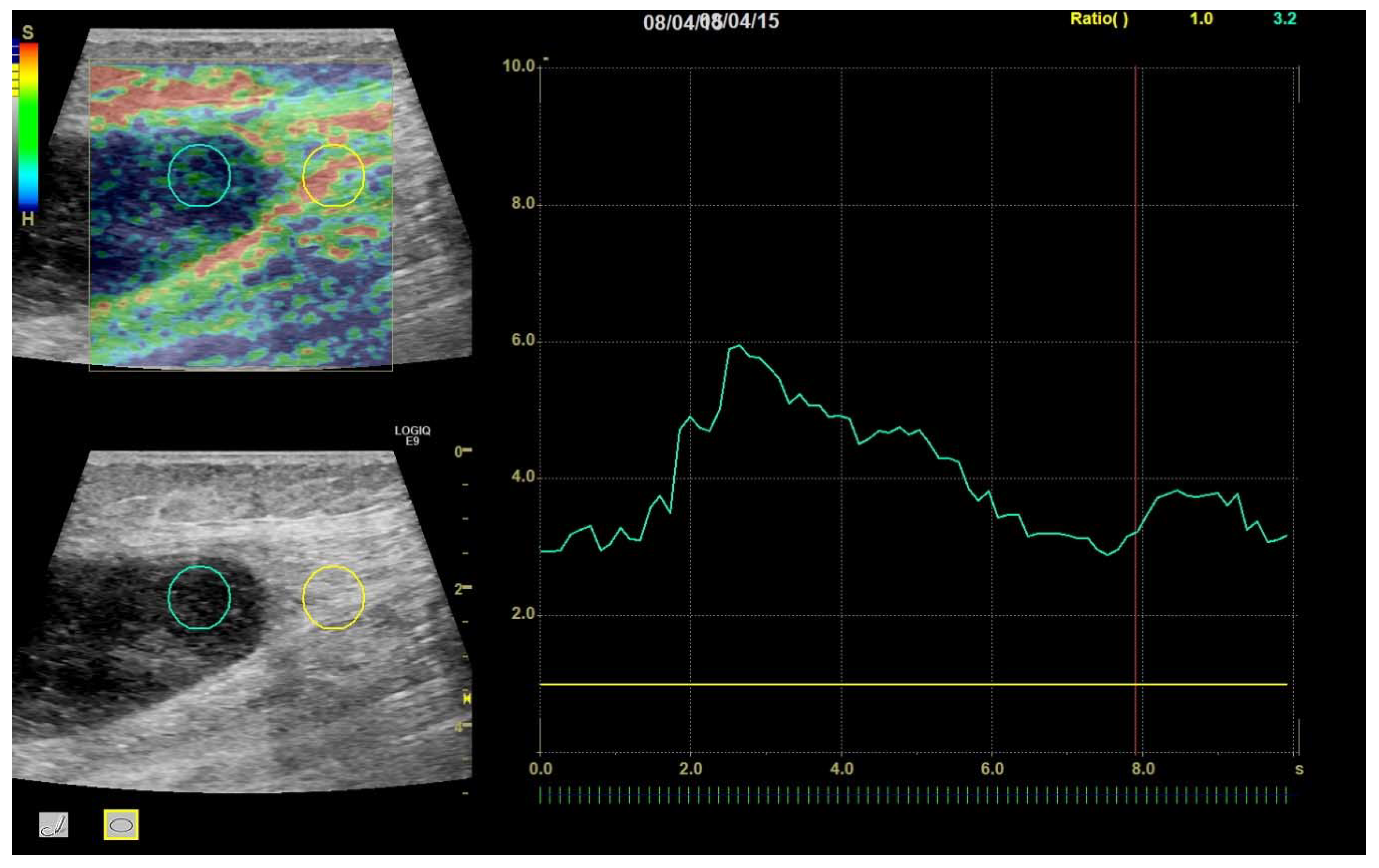 Diagnostics 10 00148 g004