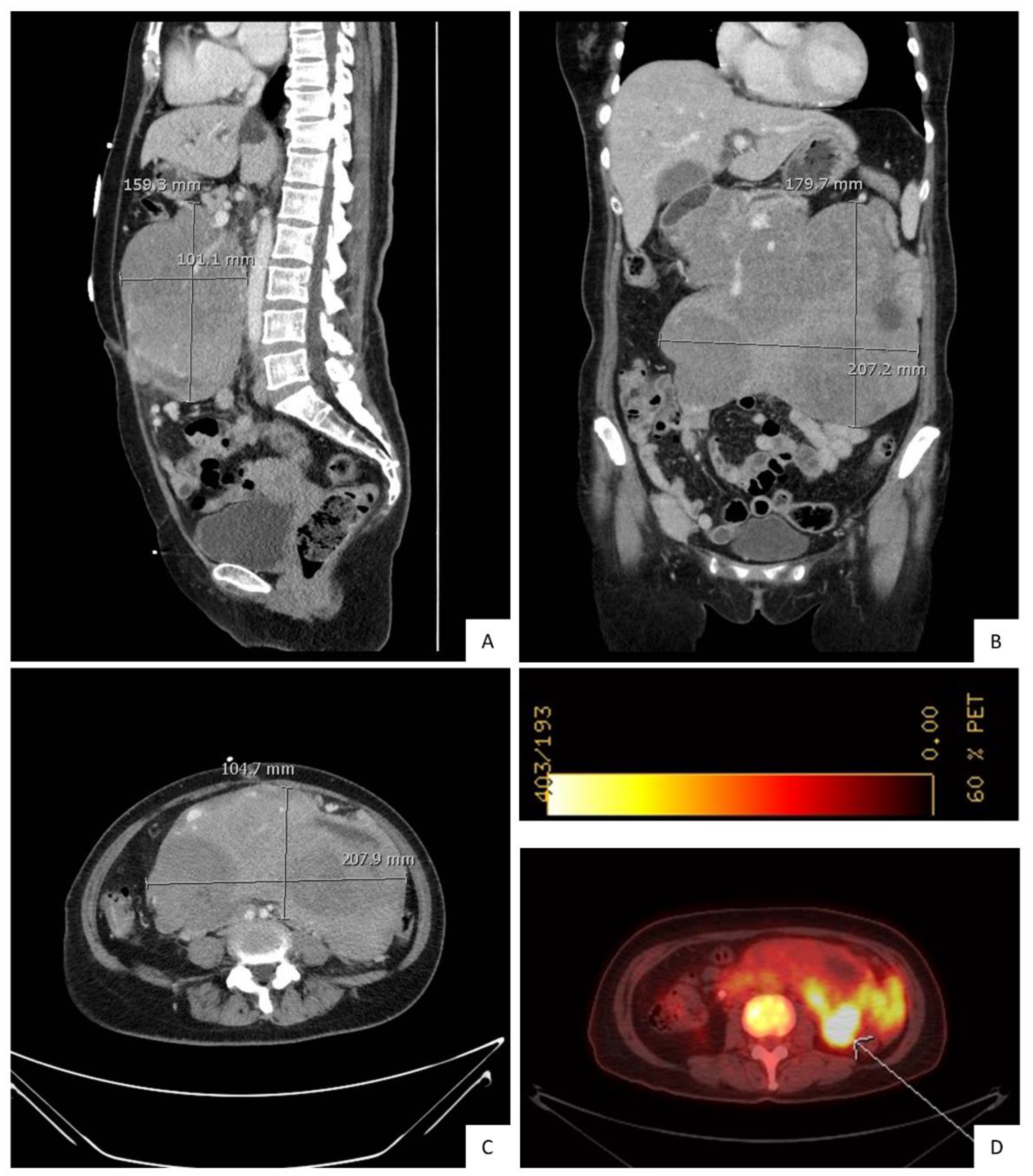 Diagnostics 10 00157 g001 Diagnostics 10 00157 g001