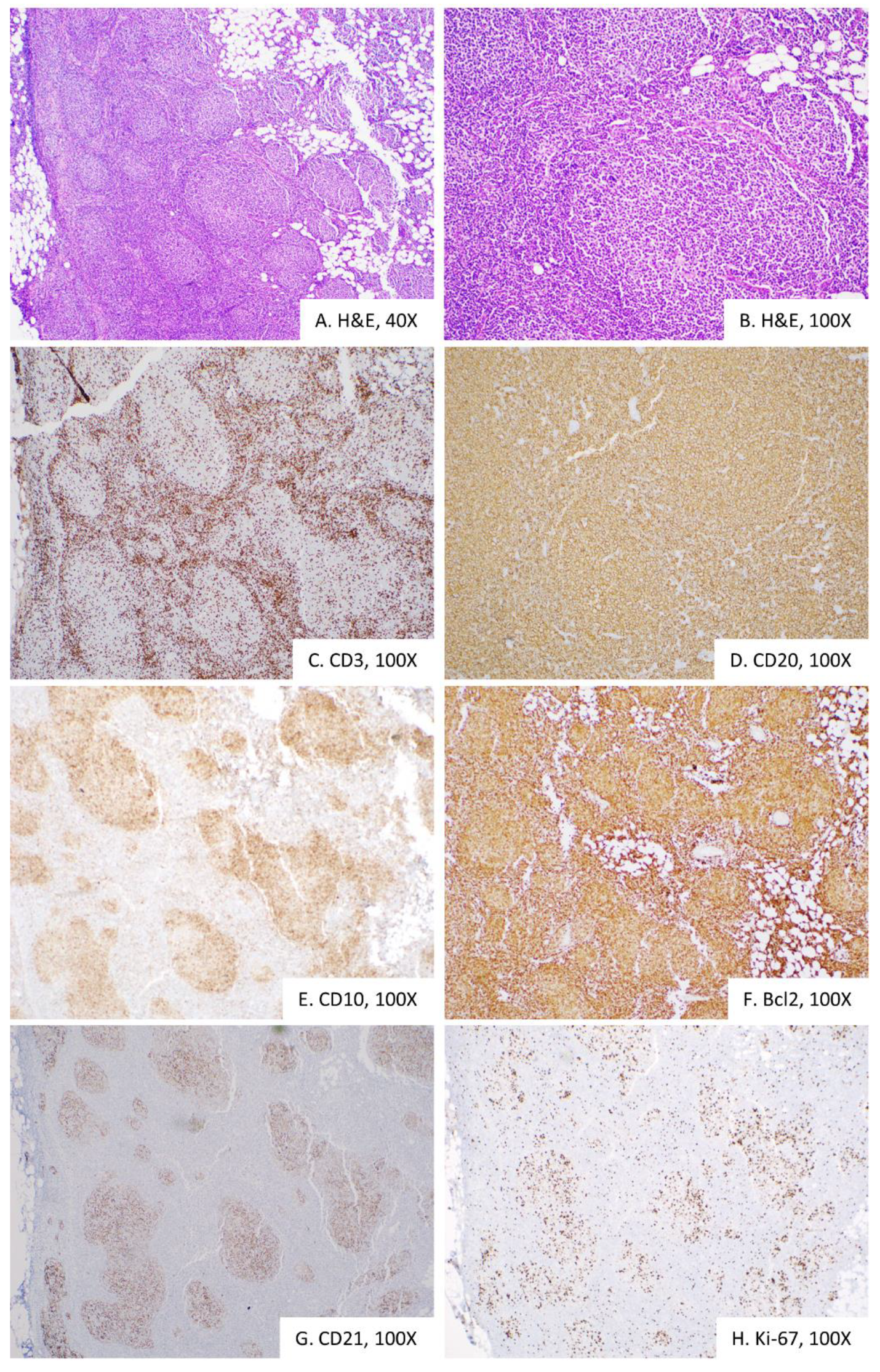 Diagnostics 10 00157 g003 Diagnostics 10 00157 g003