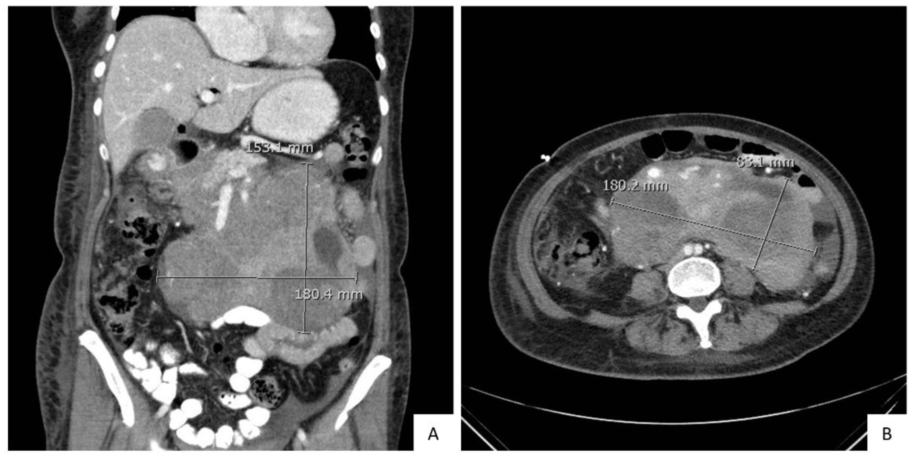 Diagnostics 10 00157 g004 Diagnostics 10 00157 g004