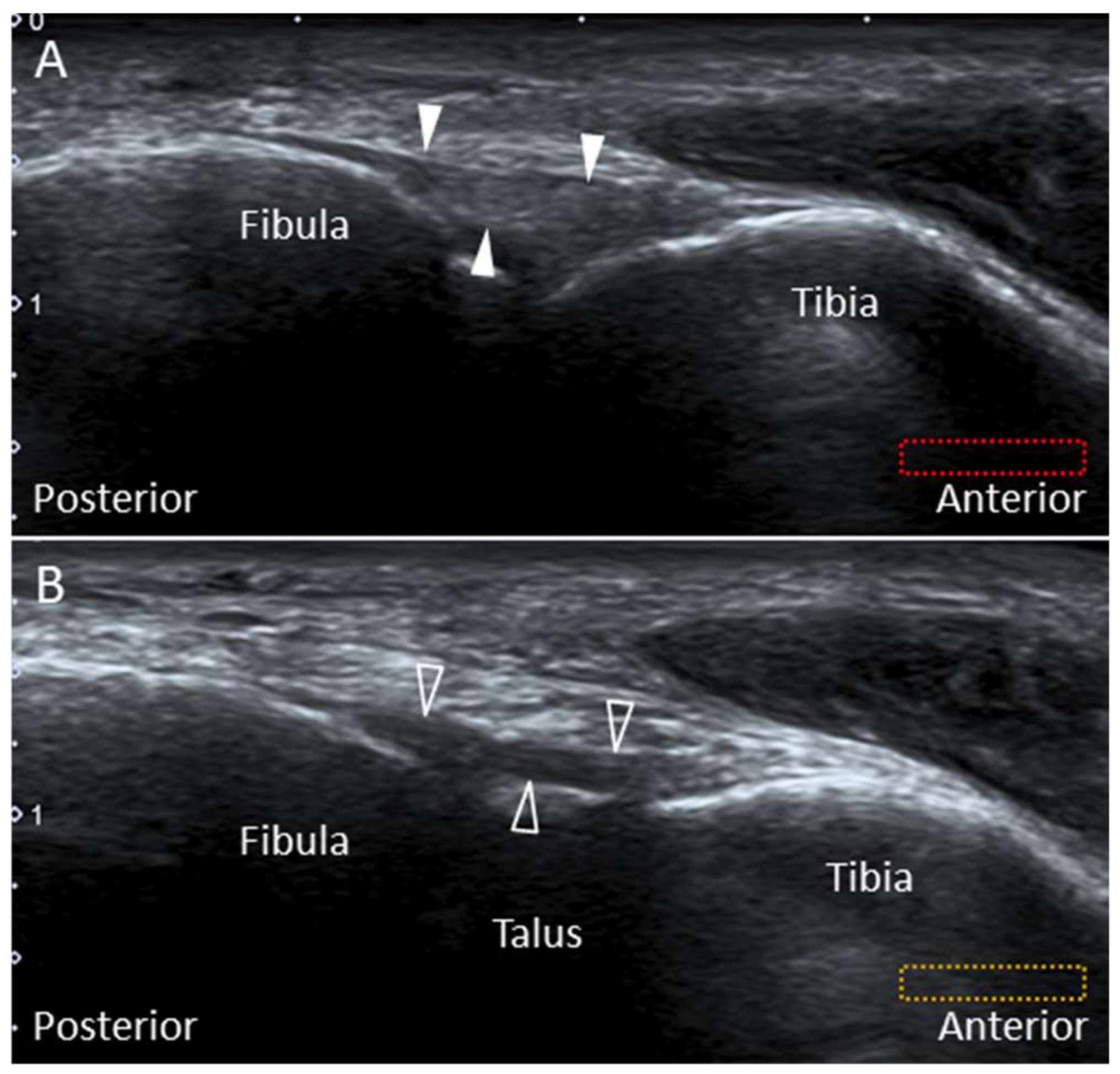Diagnostics 10 00160 g004 Diagnostics 10 00160 g004