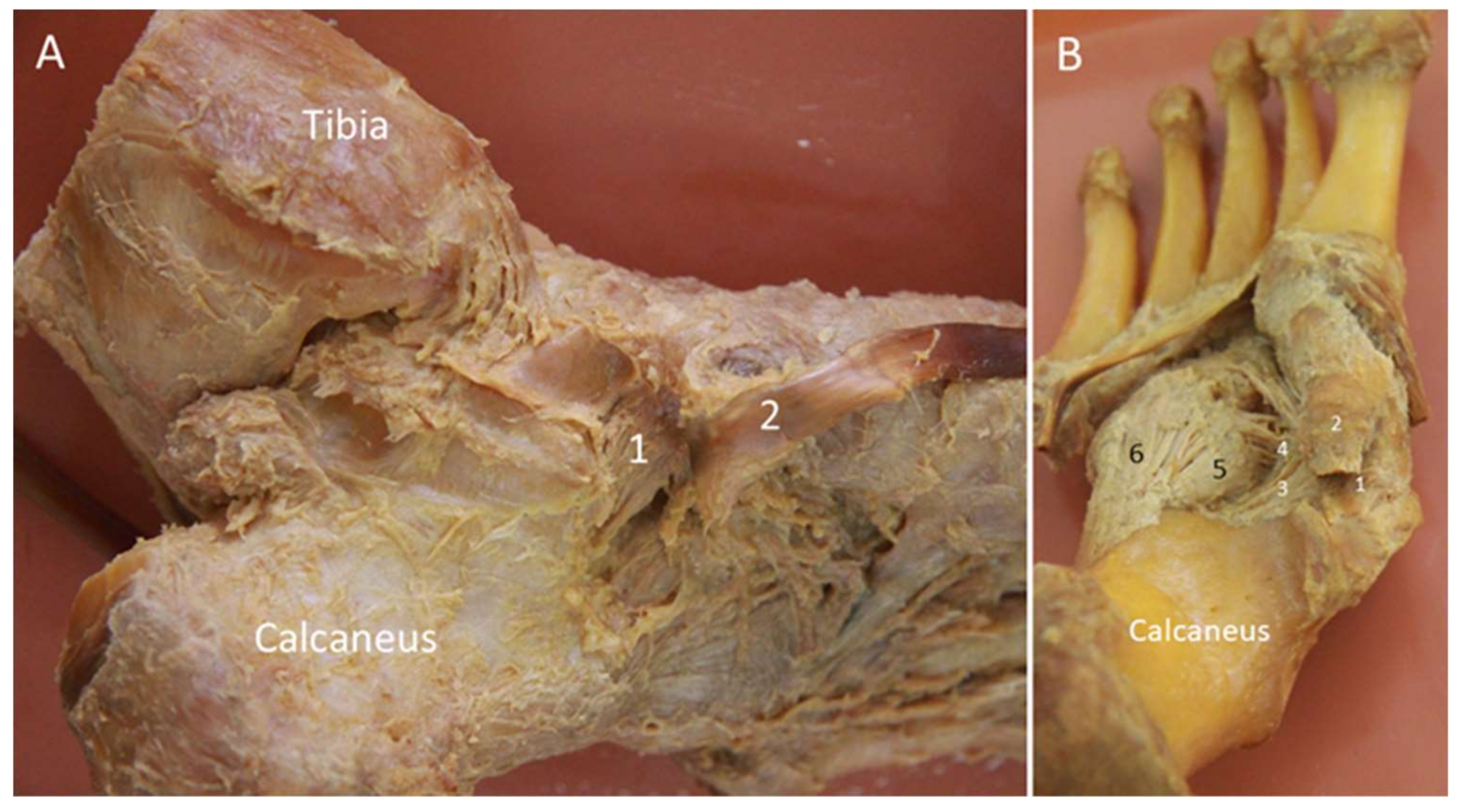 Diagnostics 10 00160 g010 Diagnostics 10 00160 g010