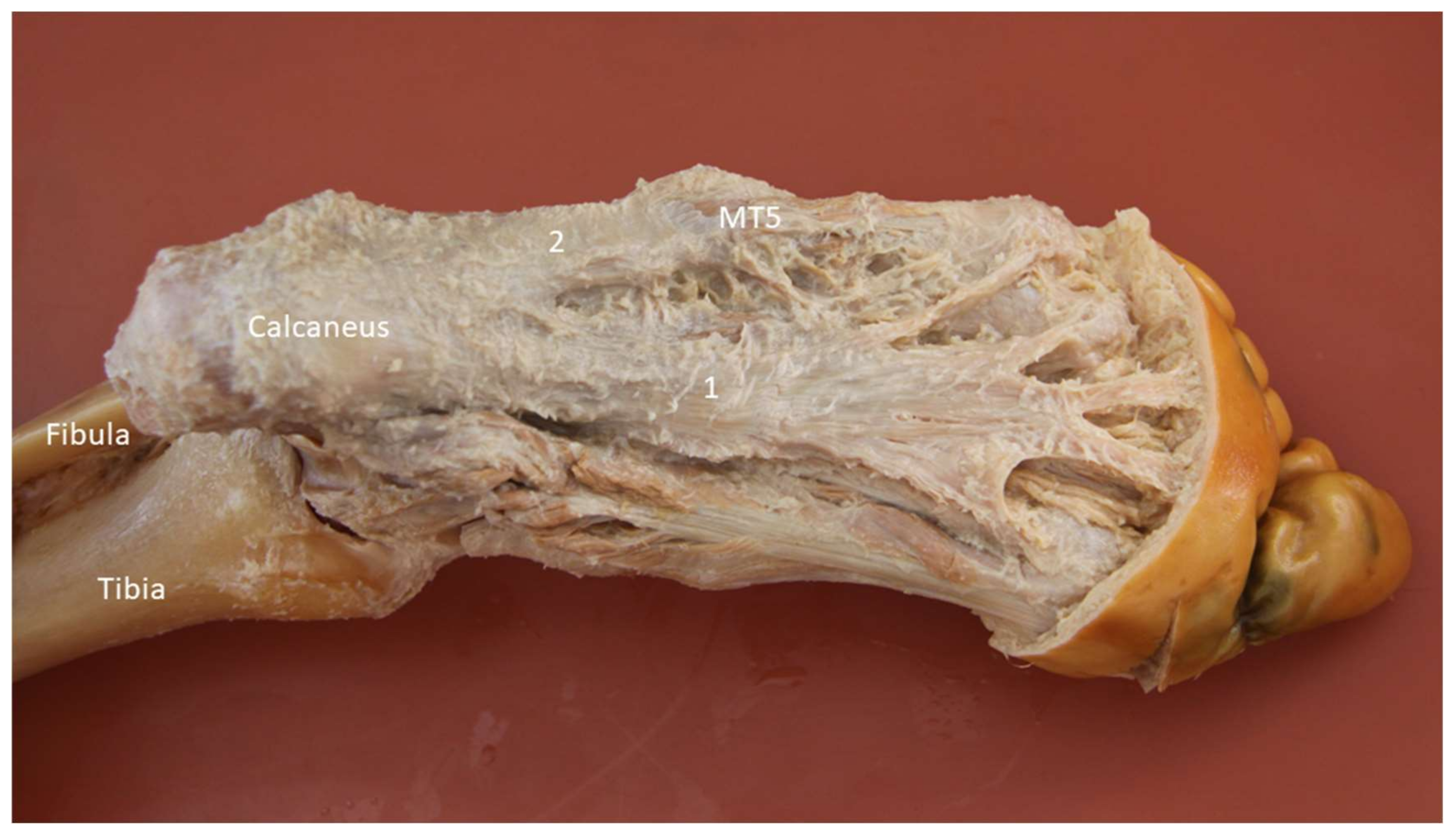 Diagnostics 10 00160 g014 Diagnostics 10 00160 g014