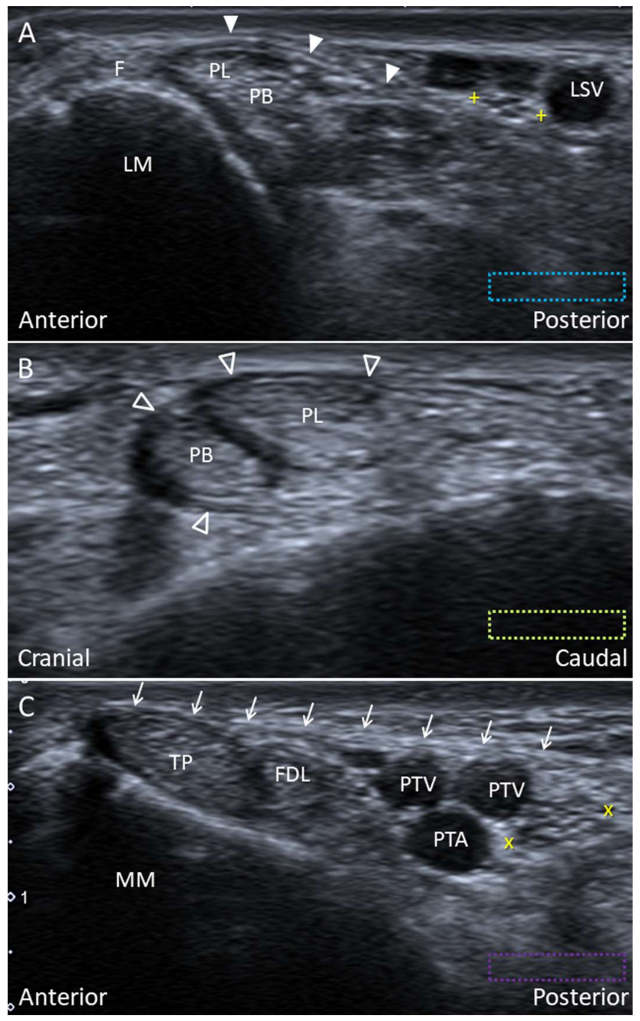 Diagnostics 10 00160 g018 Diagnostics 10 00160 g018