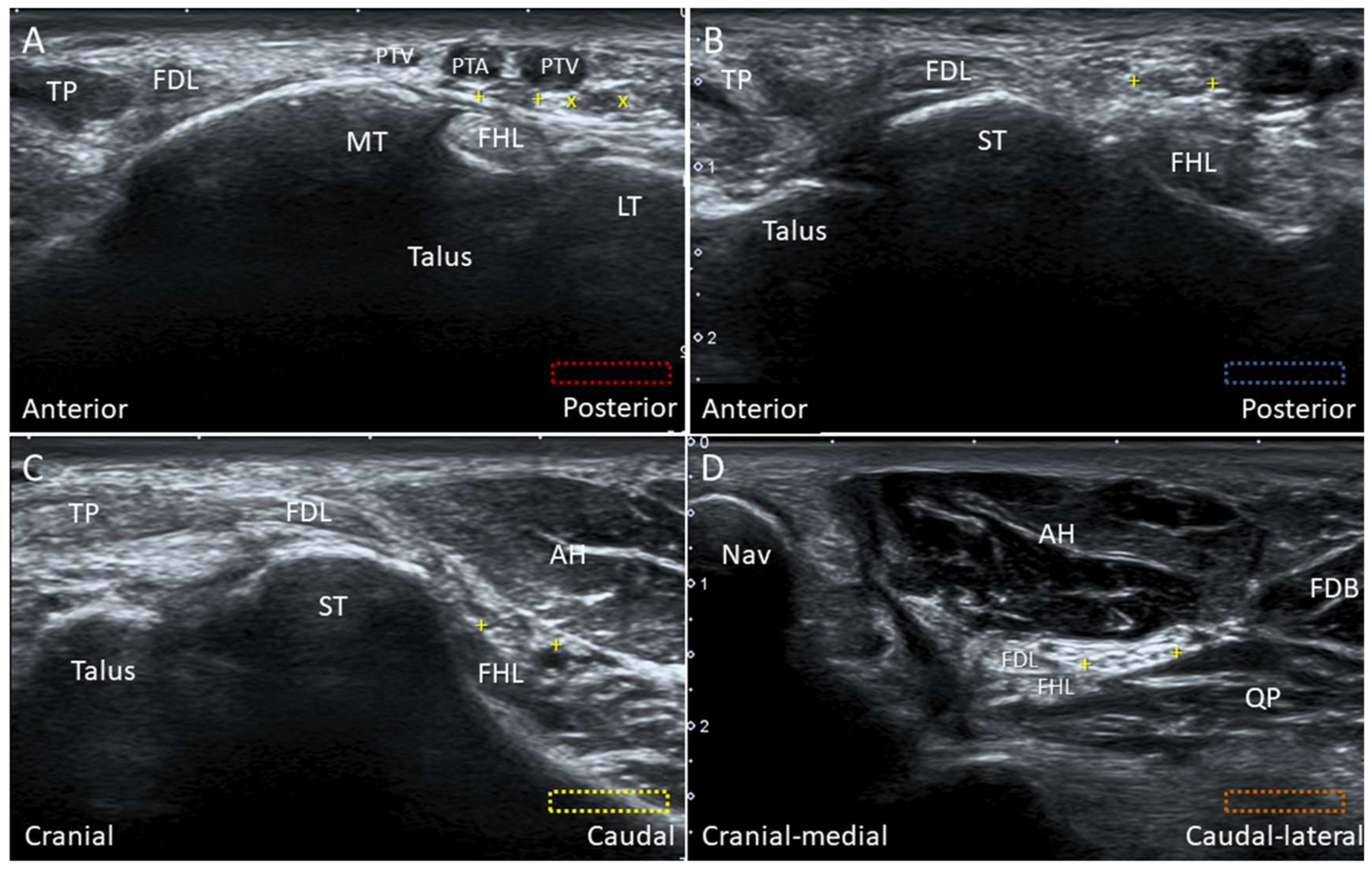 Diagnostics 10 00160 g025 Diagnostics 10 00160 g025