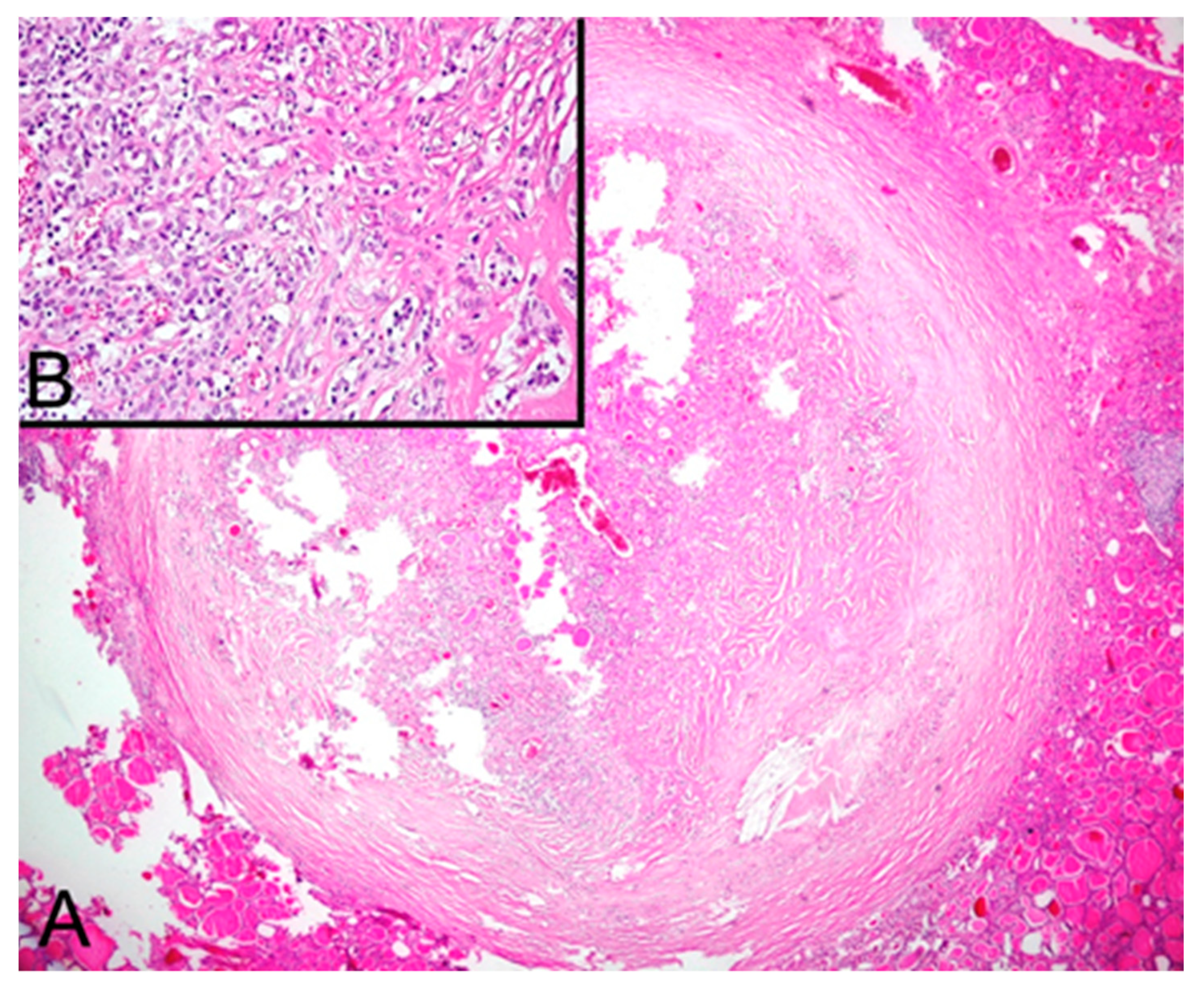Diagnostics 10 00168 g005