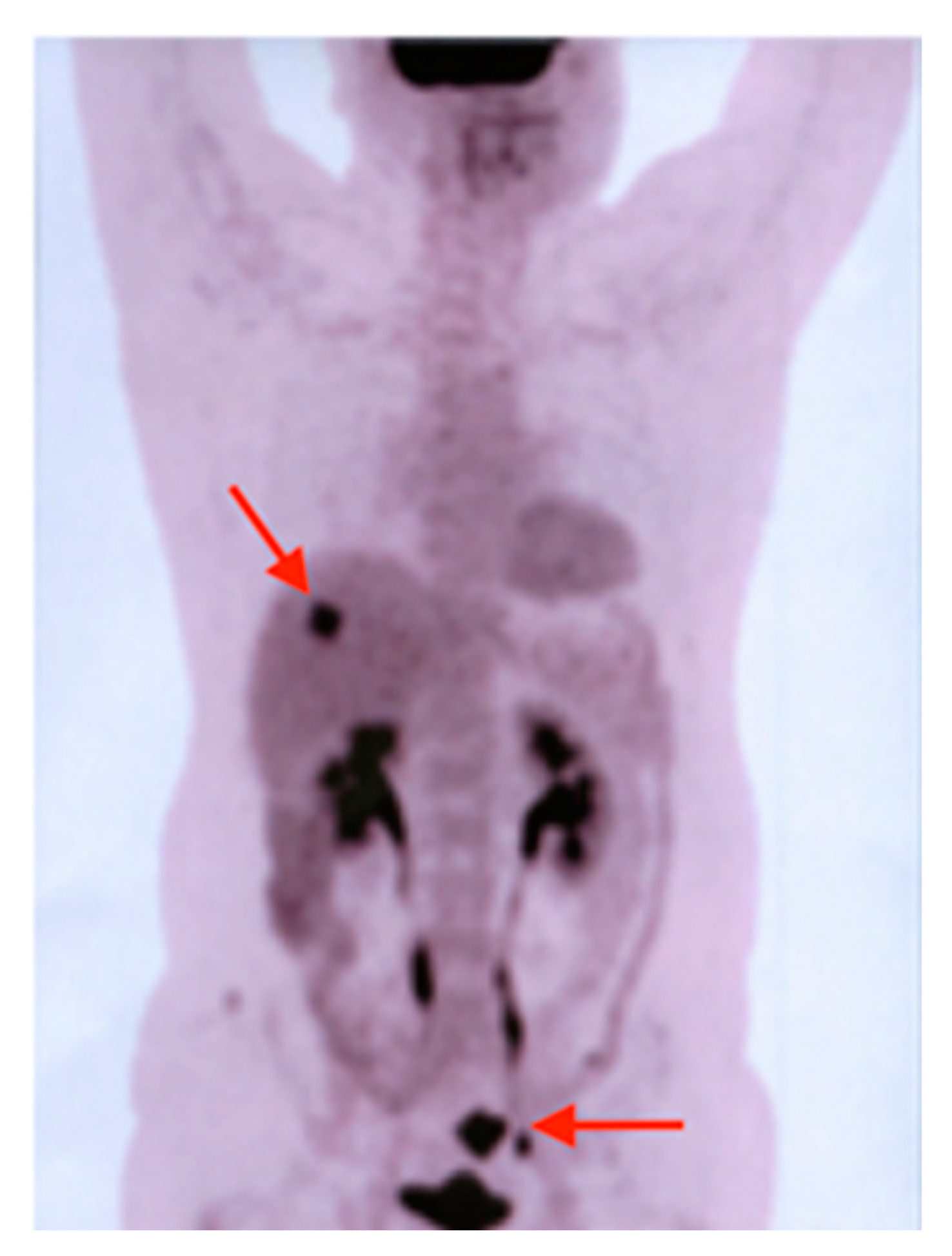 Diagnostics 10 00168 g006