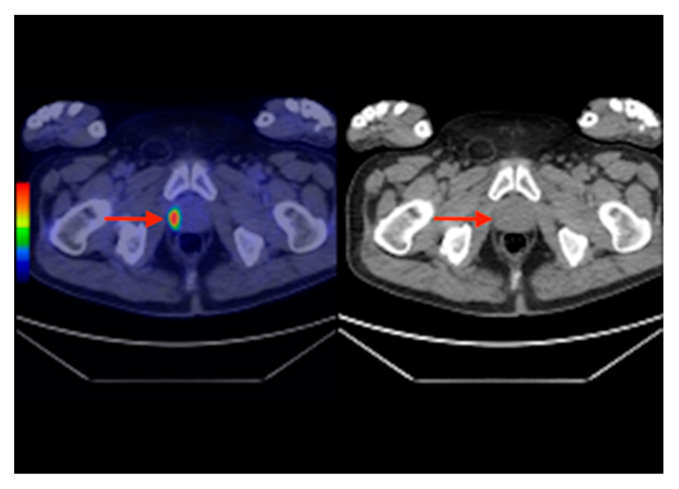 Diagnostics 10 00168 g007