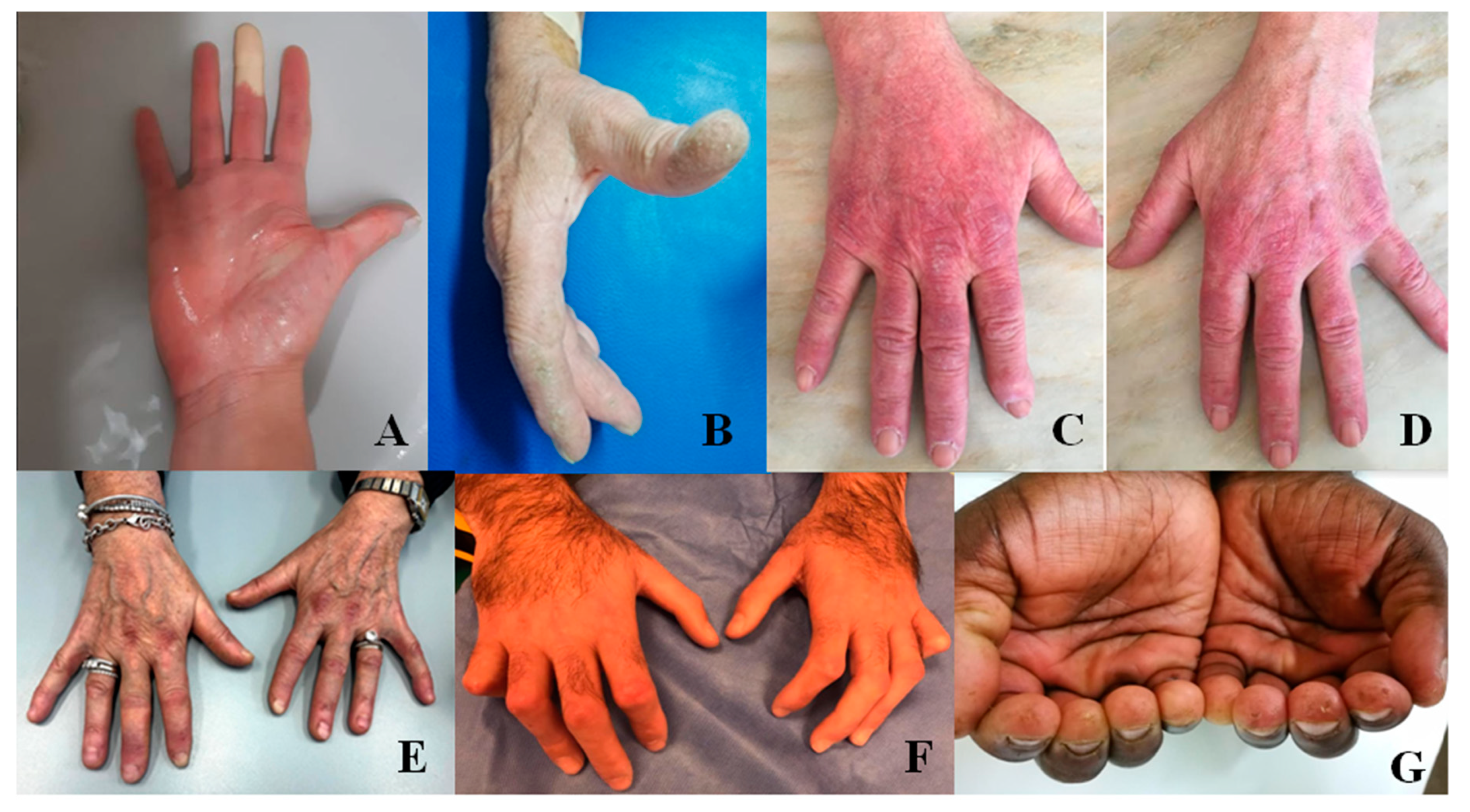 Diagnostics 10 00208 g001 Diagnostics 10 00208 g001