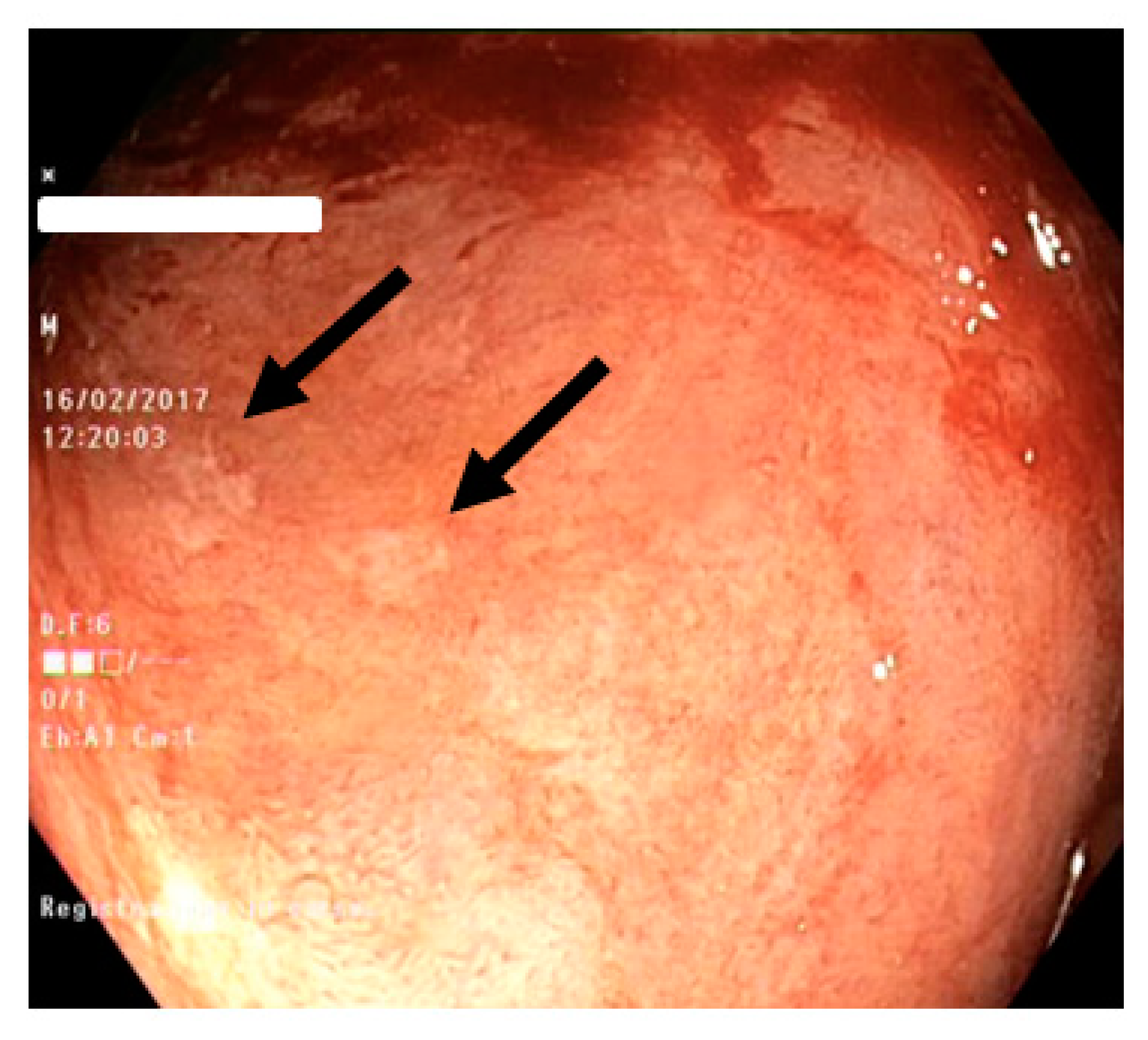 Diagnostics 10 00213 g003 Diagnostics 10 00213 g003