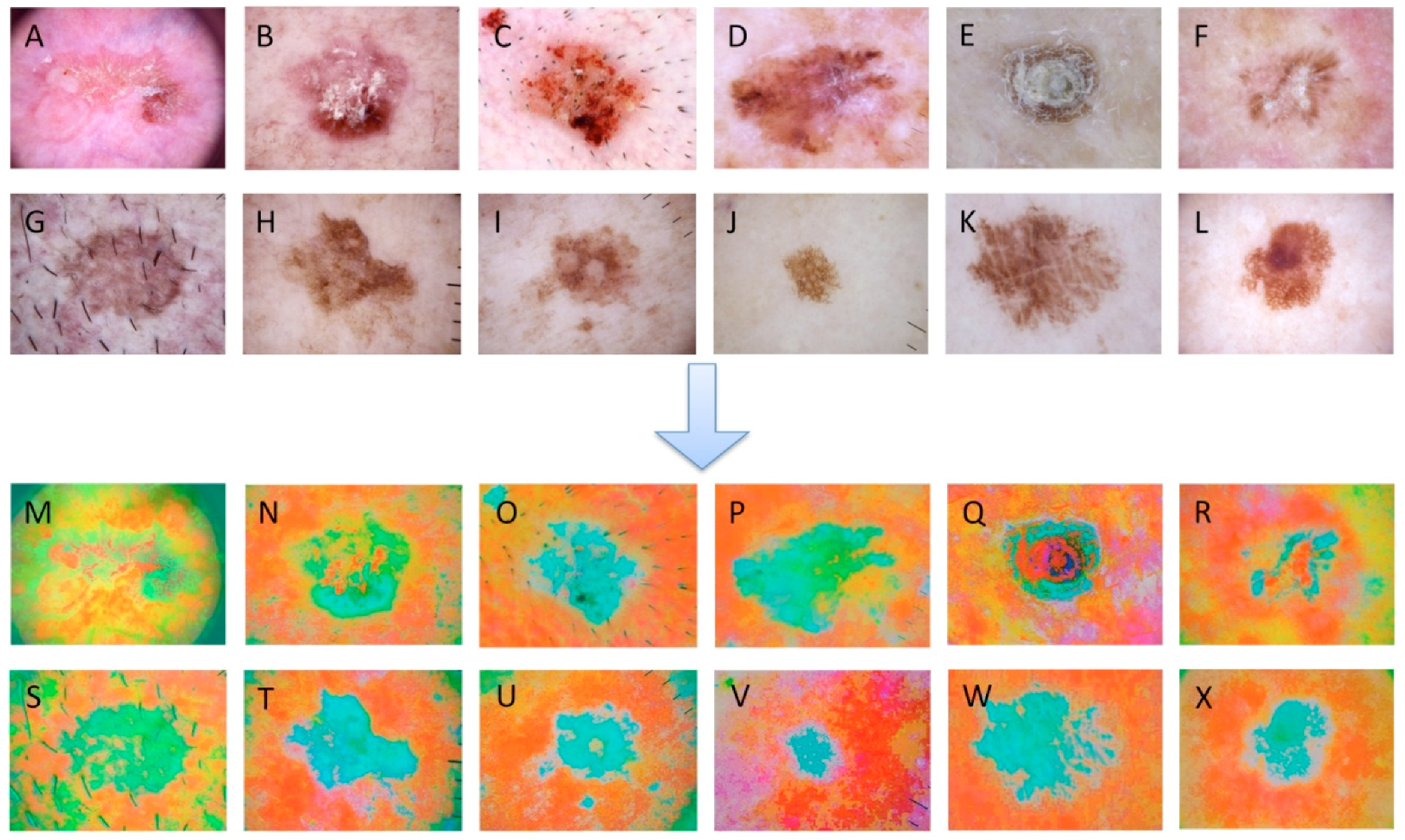 Diagnostics 10 00217 g001 Diagnostics 10 00217 g001
