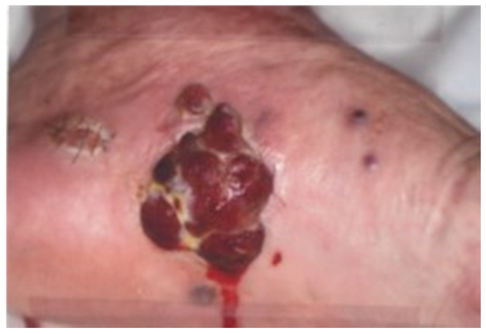 Diagnostics 10 00218 g001