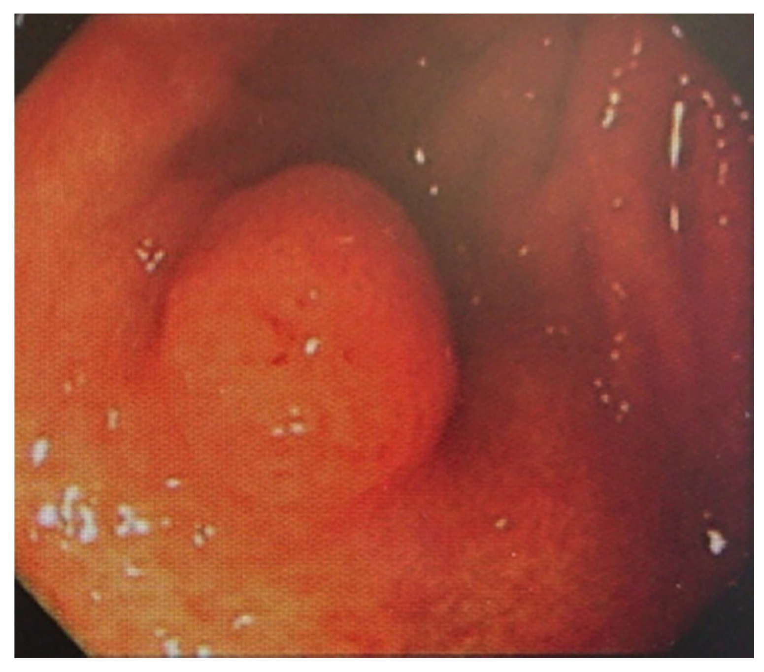 Diagnostics 10 00218 g003