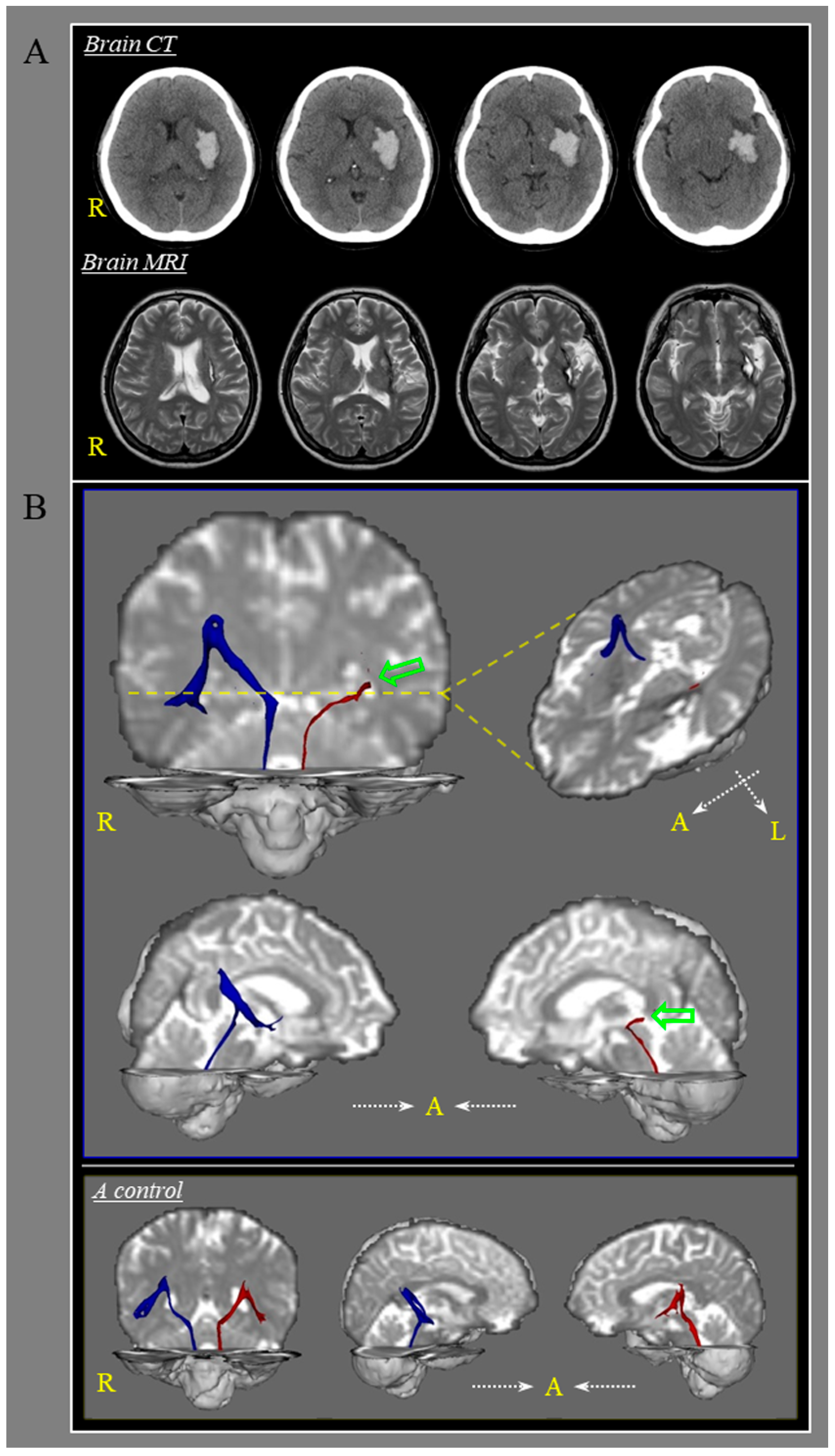 Diagnostics 10 00220 g001