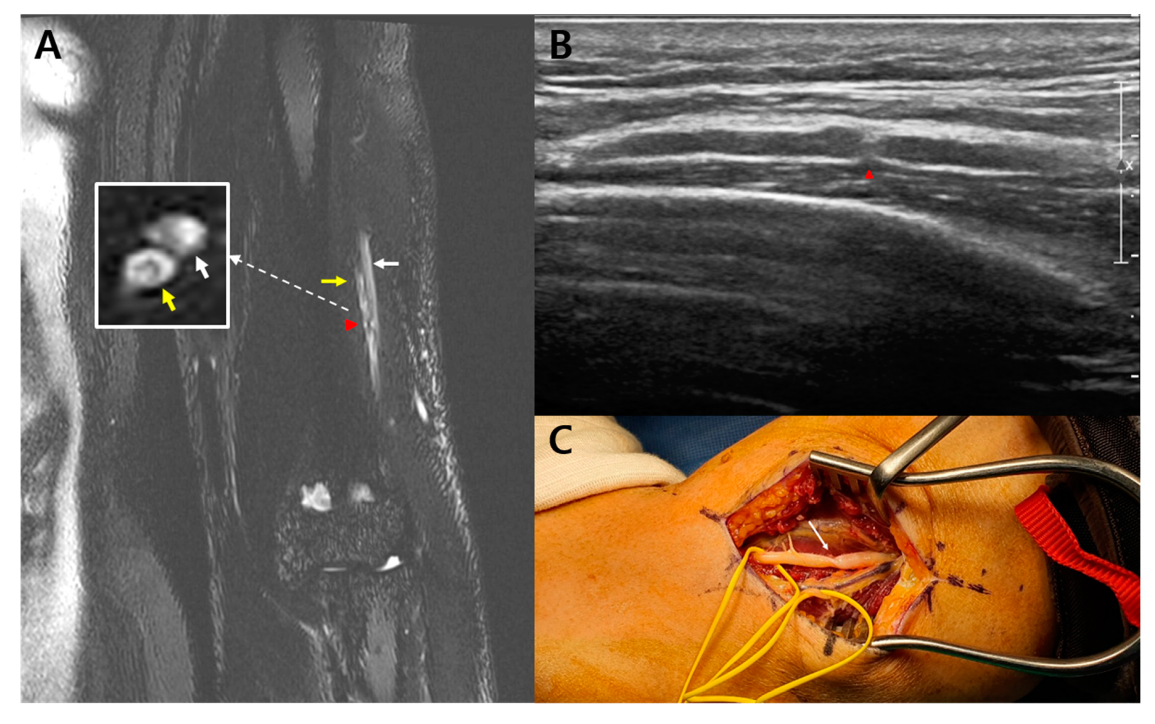 Diagnostics 10 00232 g001
