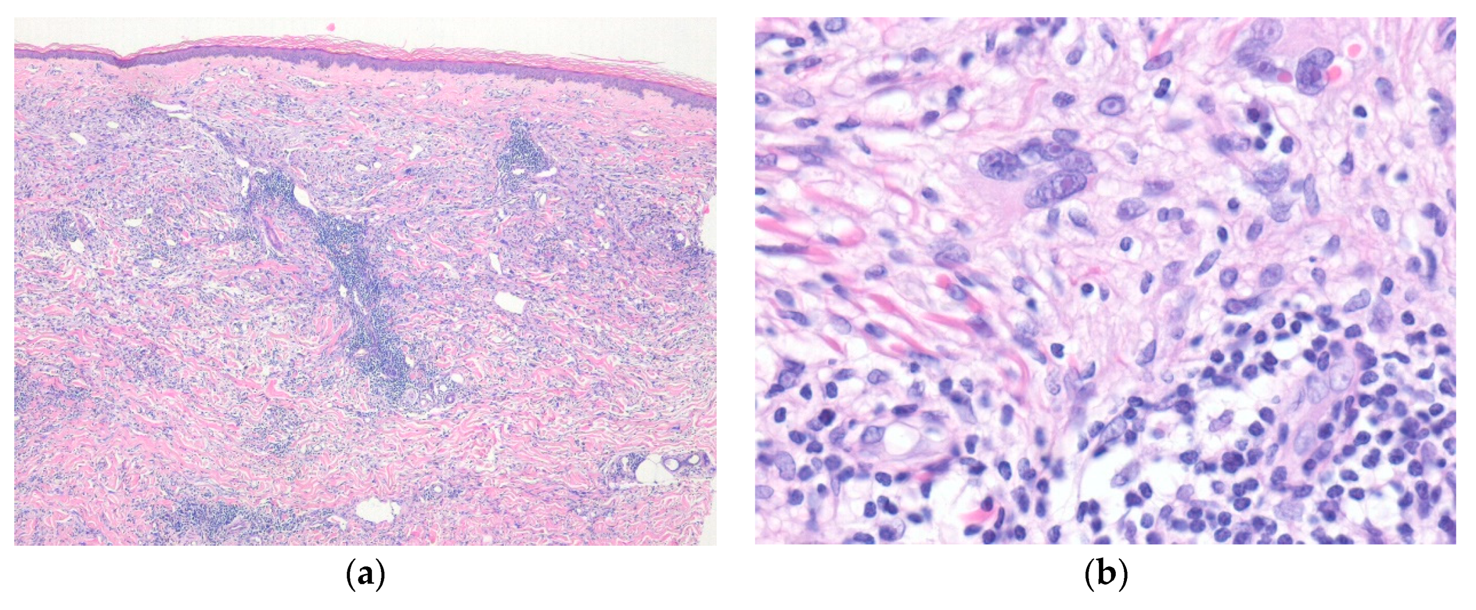 Diagnostics 10 00233 g001 Diagnostics 10 00233 g001