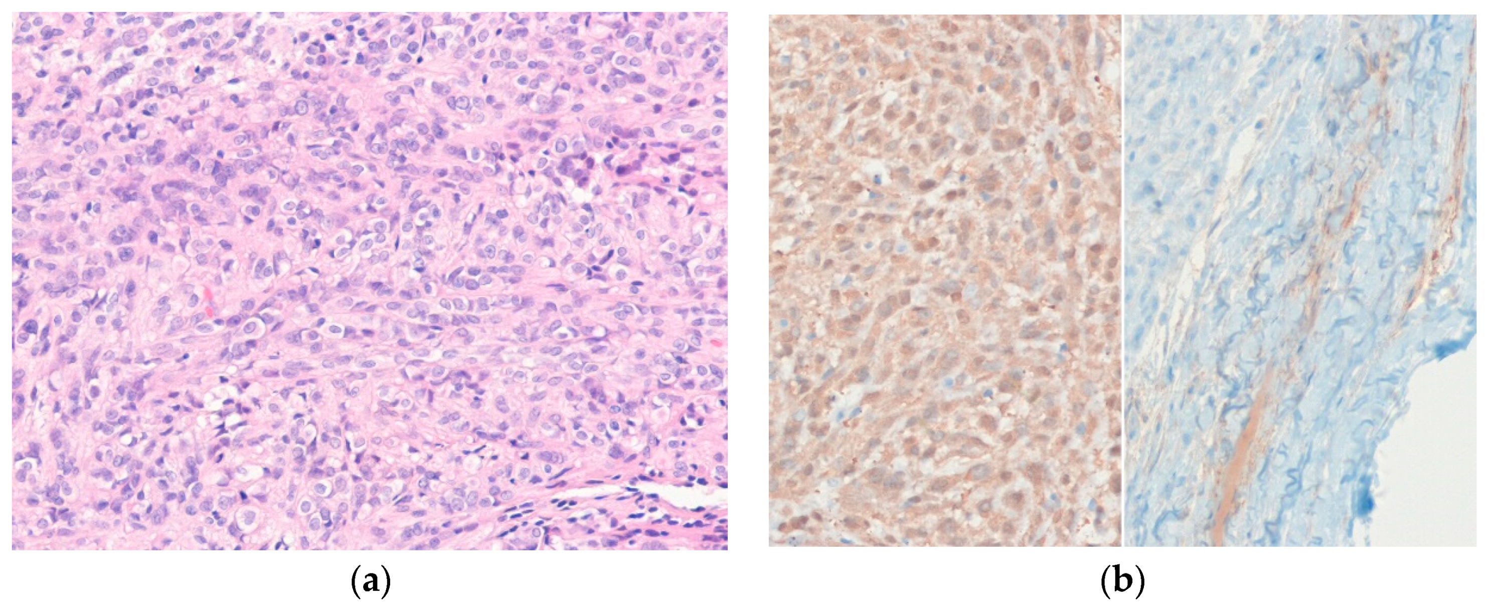 Diagnostics 10 00233 g004 Diagnostics 10 00233 g004