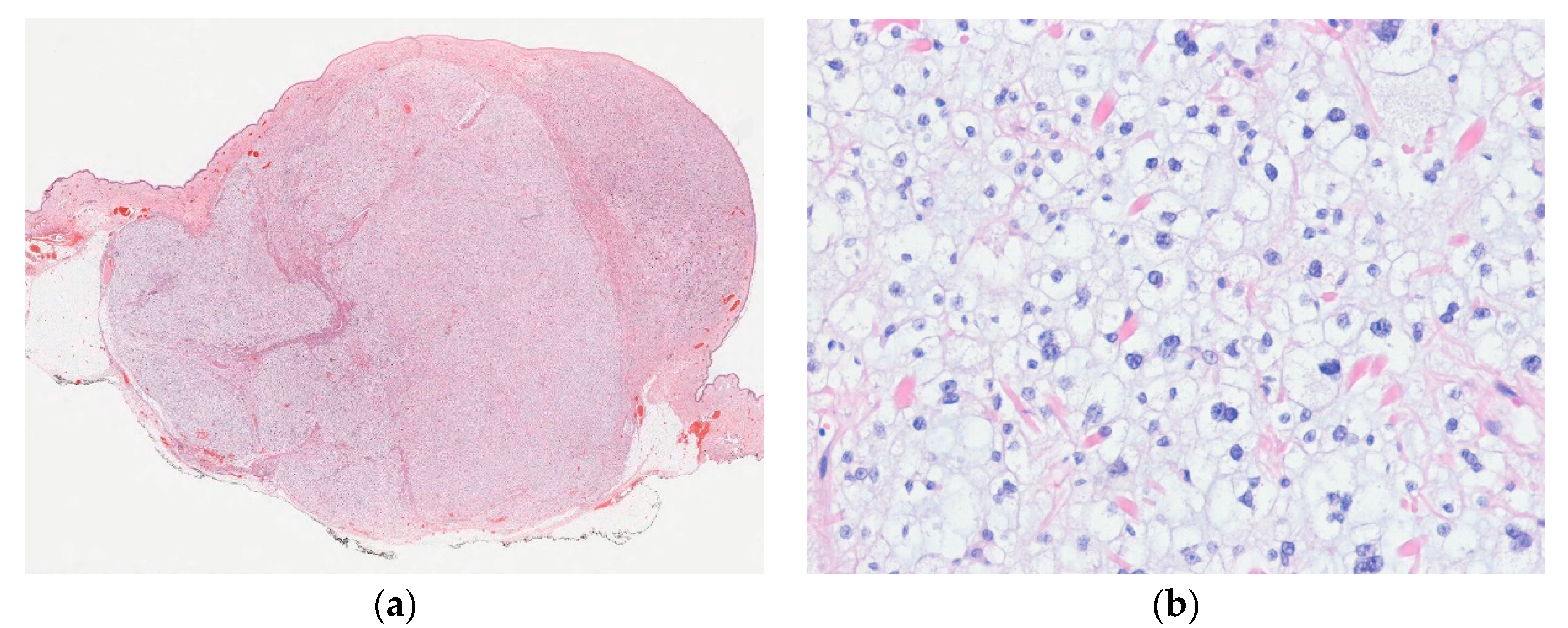 Diagnostics 10 00233 g006 Diagnostics 10 00233 g006