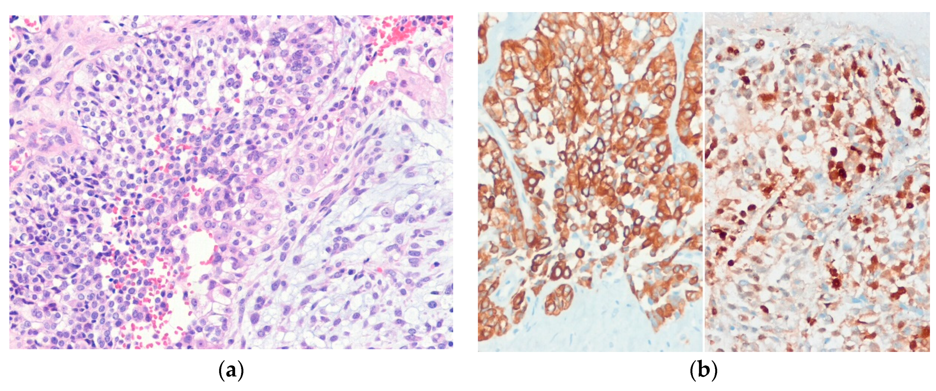 Diagnostics 10 00233 g008 Diagnostics 10 00233 g008