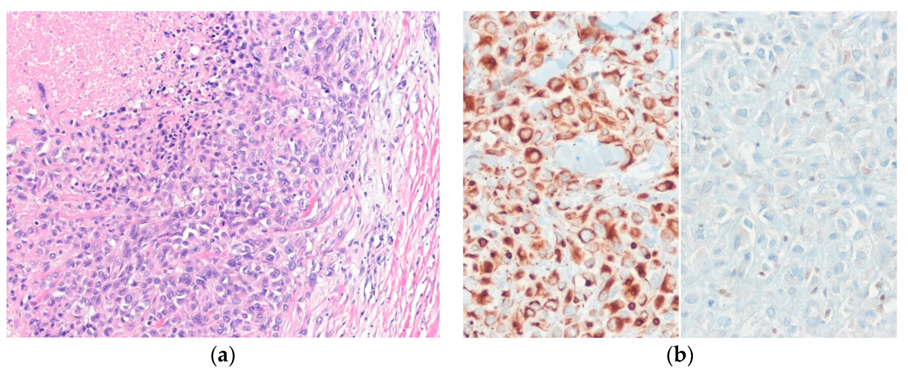 Diagnostics 10 00233 g009 Diagnostics 10 00233 g009