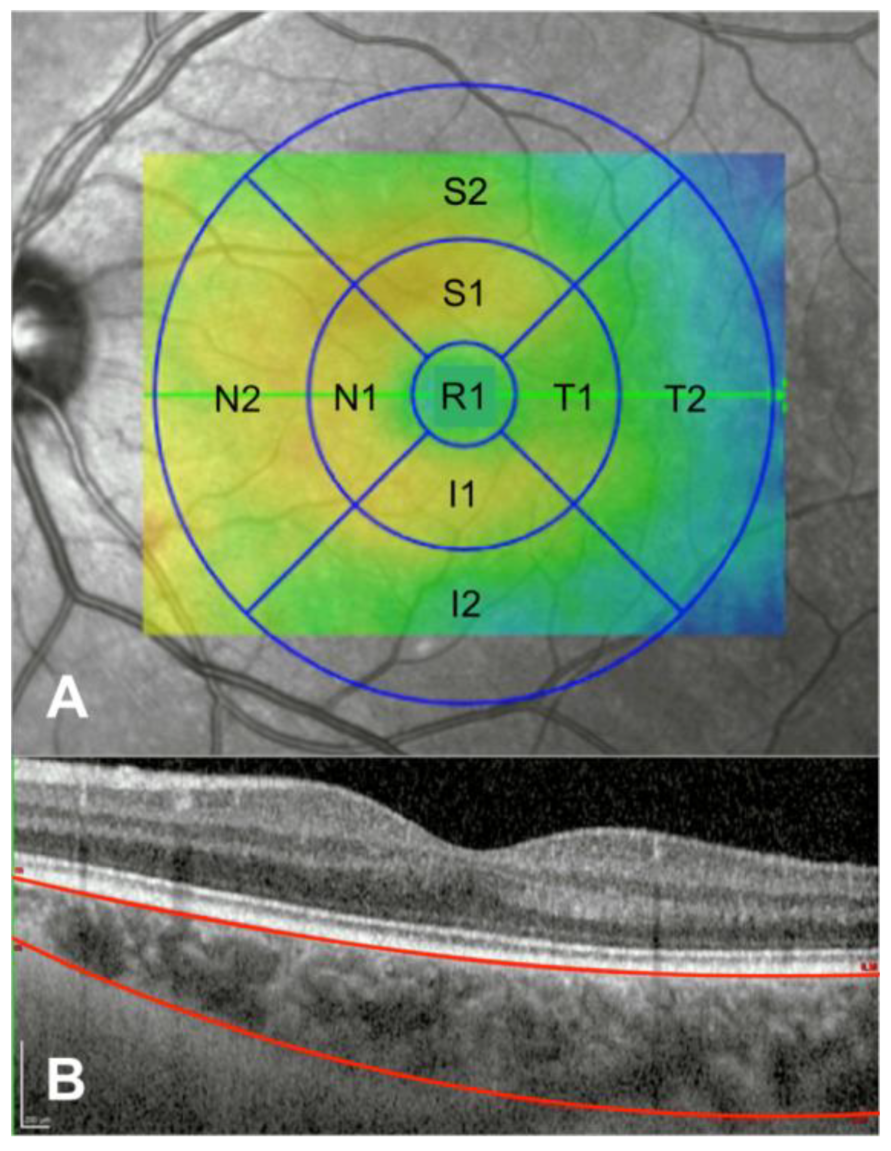 Diagnostics 10 00235 g001 Diagnostics 10 00235 g001
