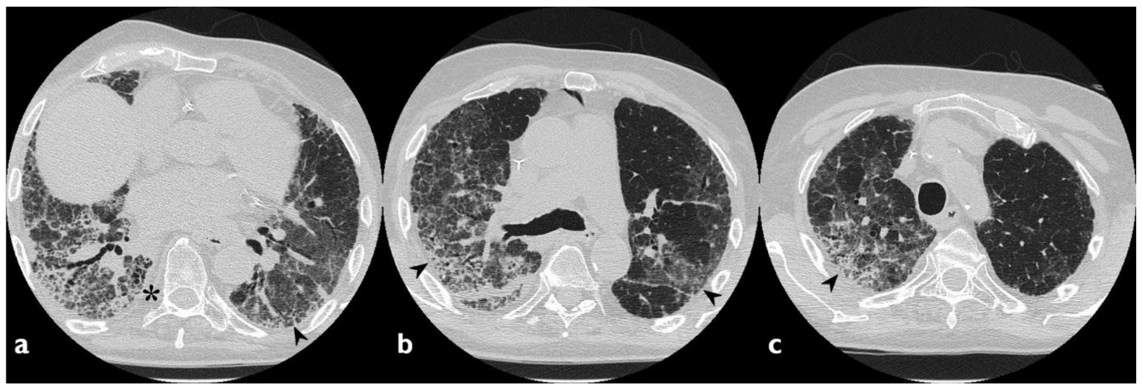 Diagnostics 10 00244 g004 Diagnostics 10 00244 g004