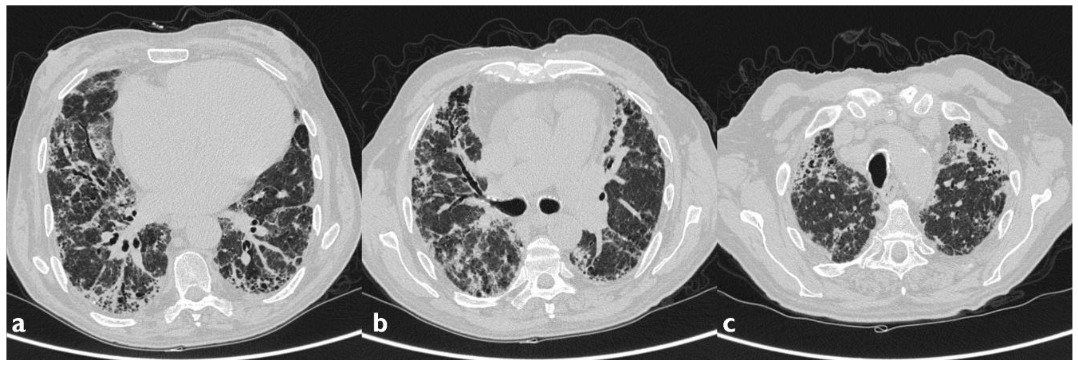 Diagnostics 10 00244 g007 Diagnostics 10 00244 g007
