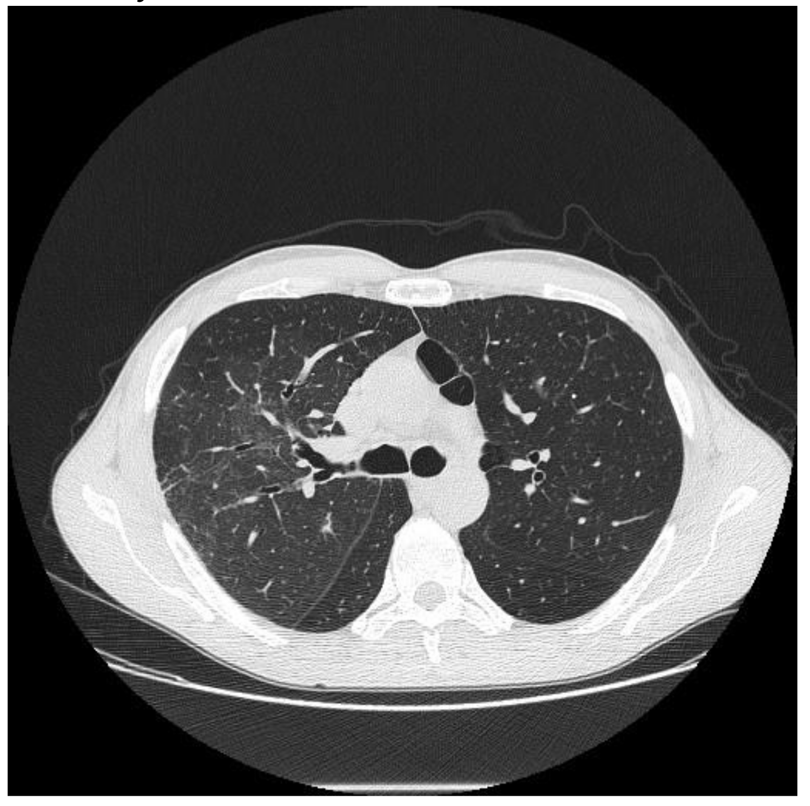 Diagnostics 10 00244 g009 Diagnostics 10 00244 g009