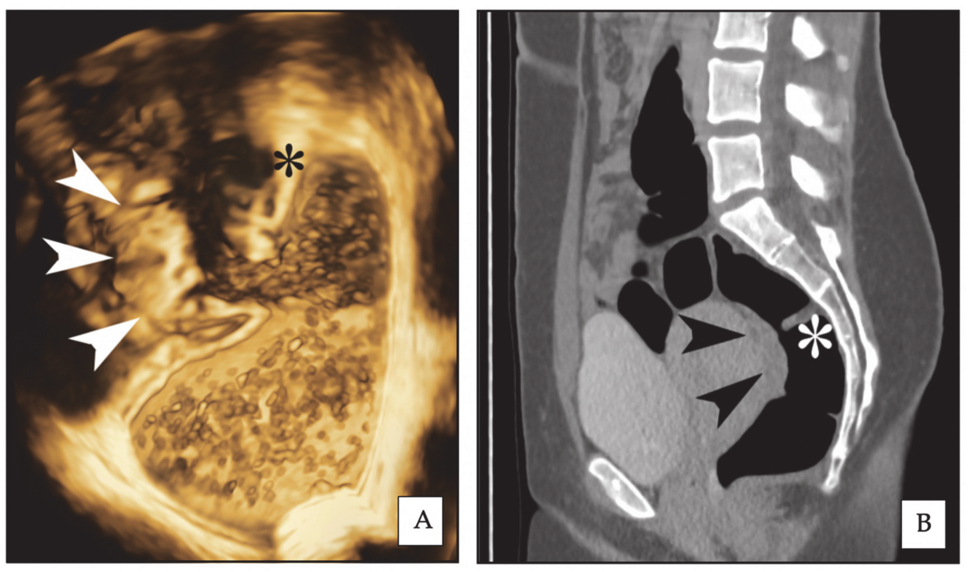 Diagnostics 10 00252 g001
