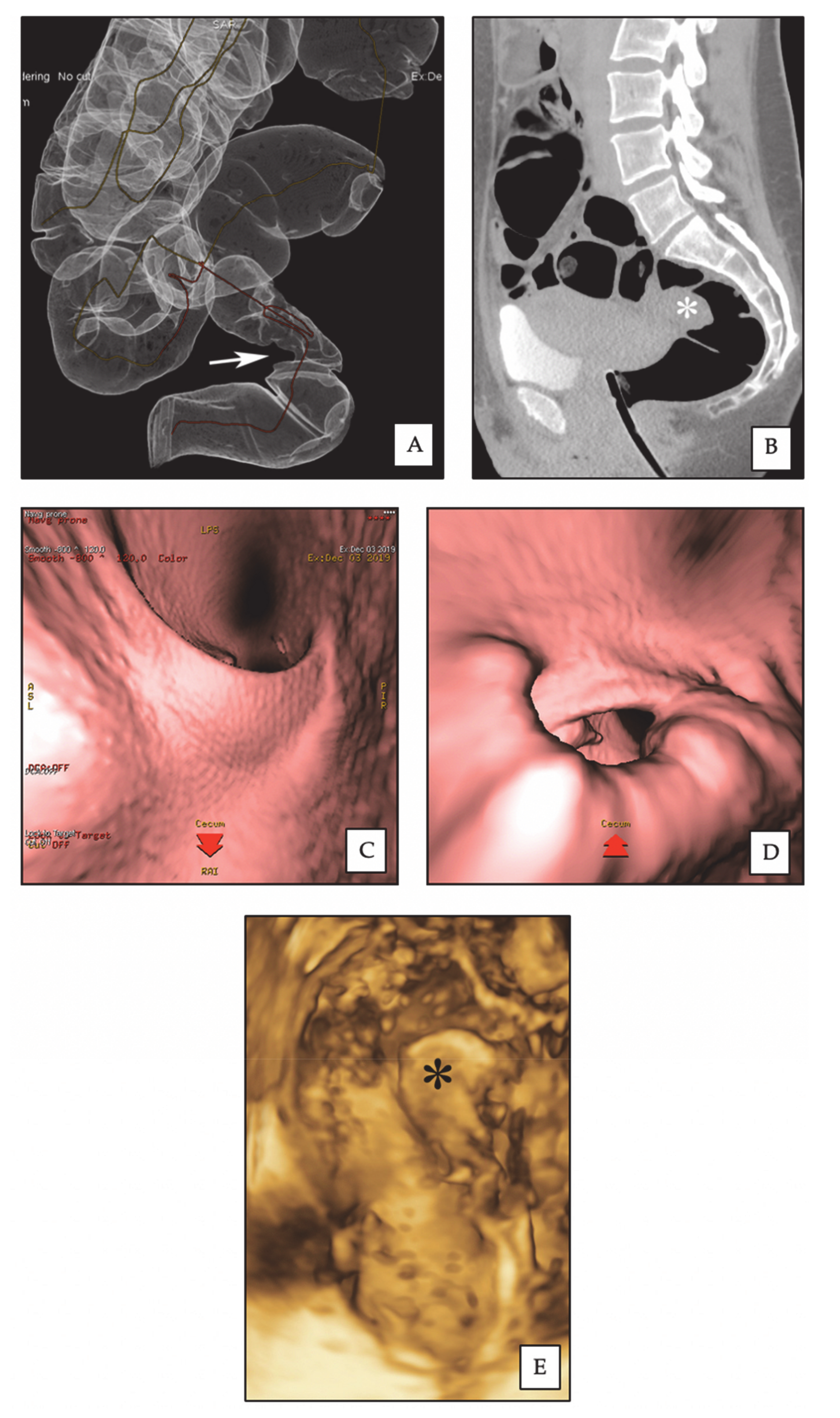 Diagnostics 10 00252 g002
