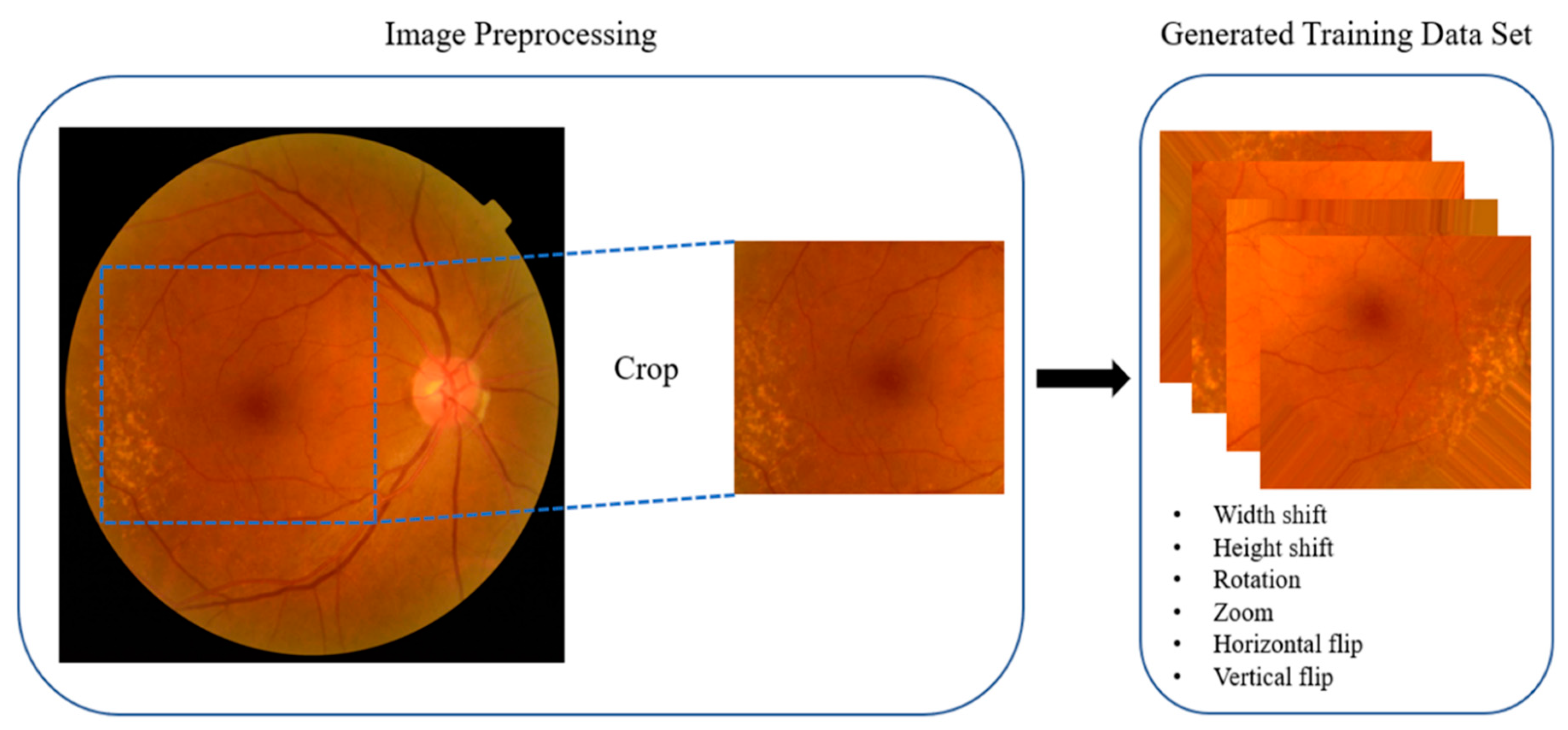 From sklearn import preprocessing. Препроцессинг это. Dataset images. Preprocessing.