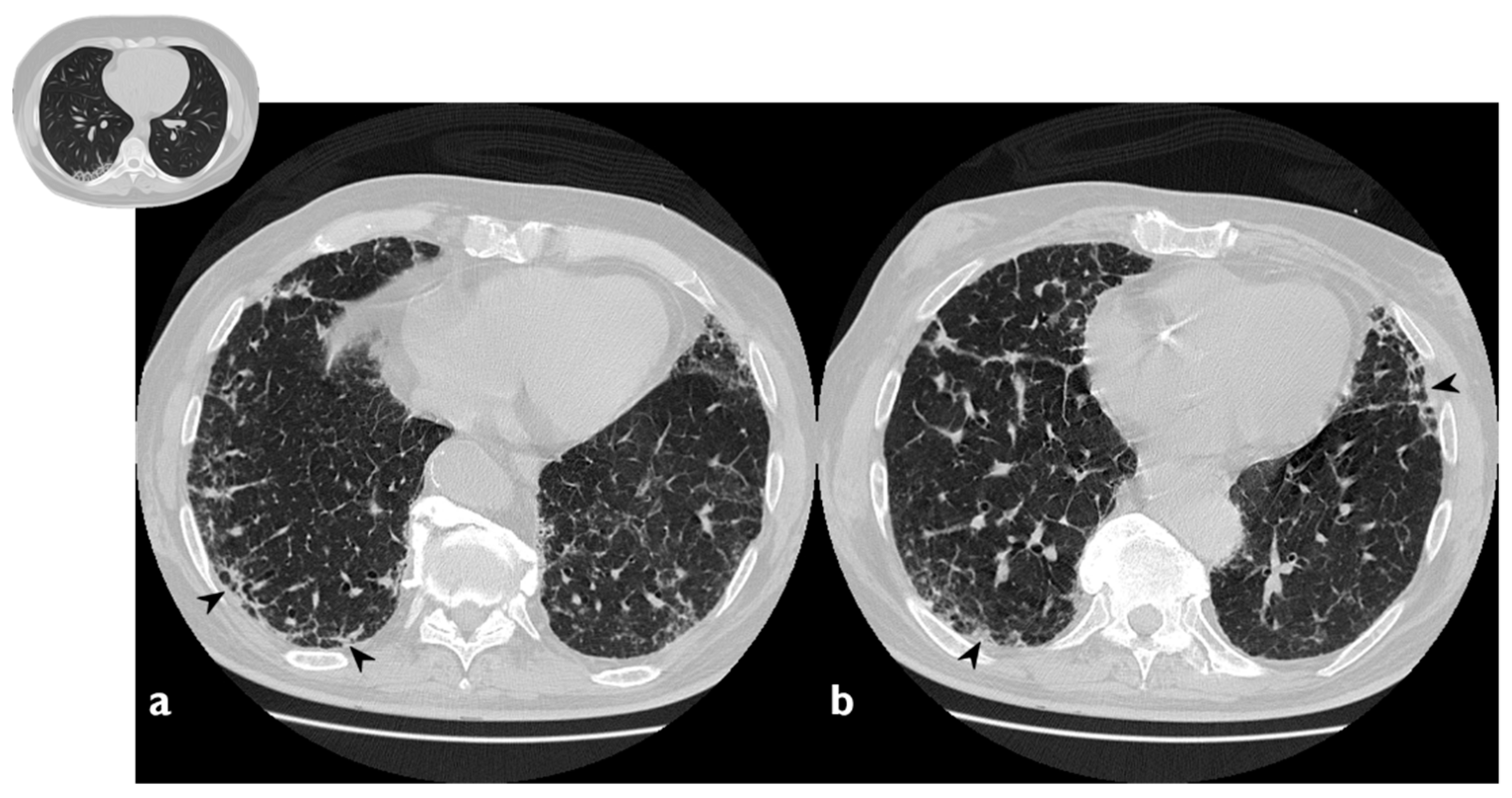 Diagnostics 10 00262 g005