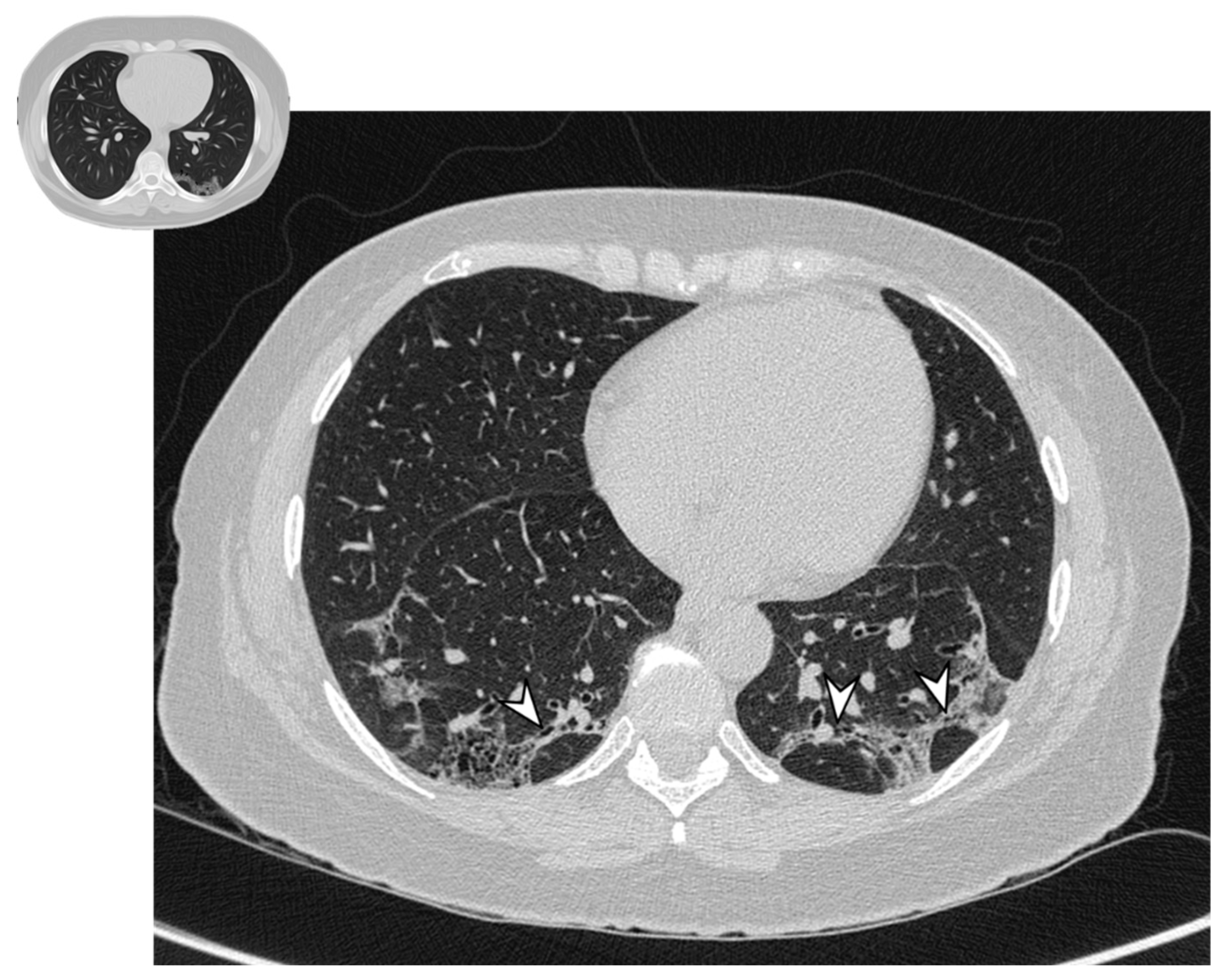 Diagnostics 10 00262 g006