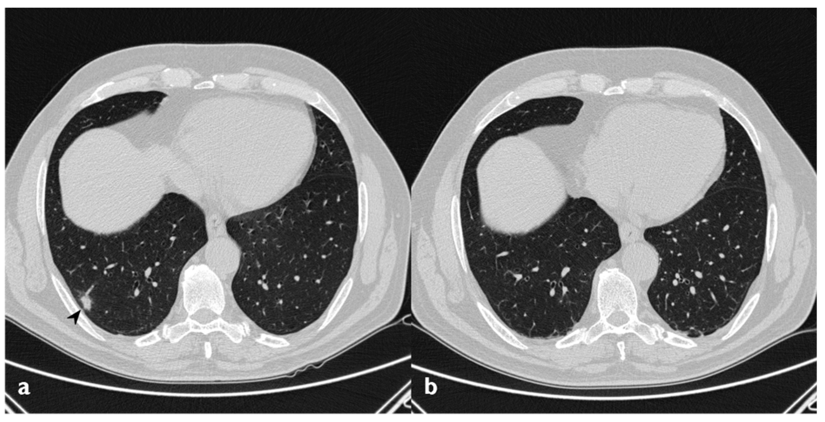 Diagnostics 10 00262 g011