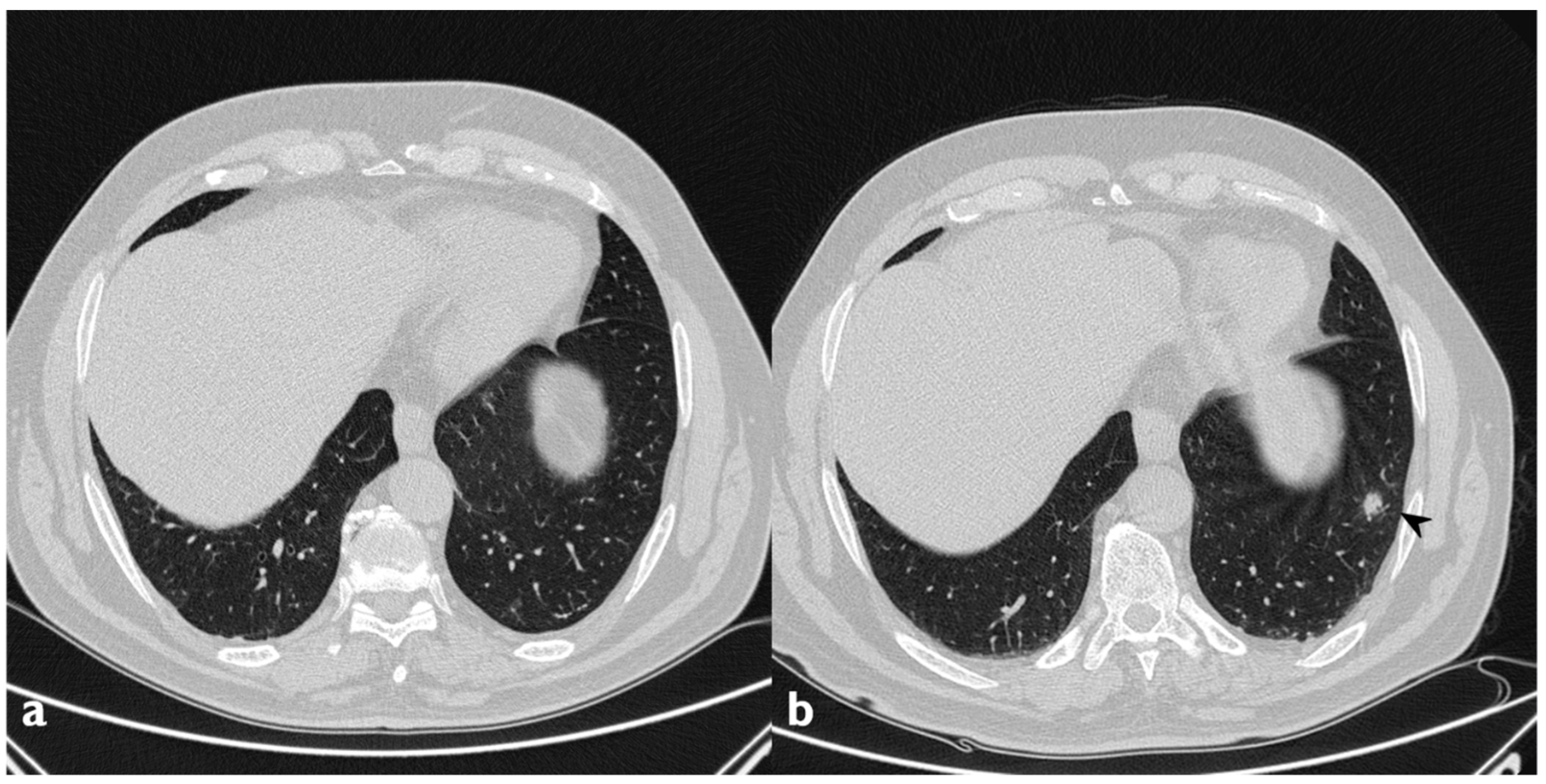 Diagnostics 10 00262 g012