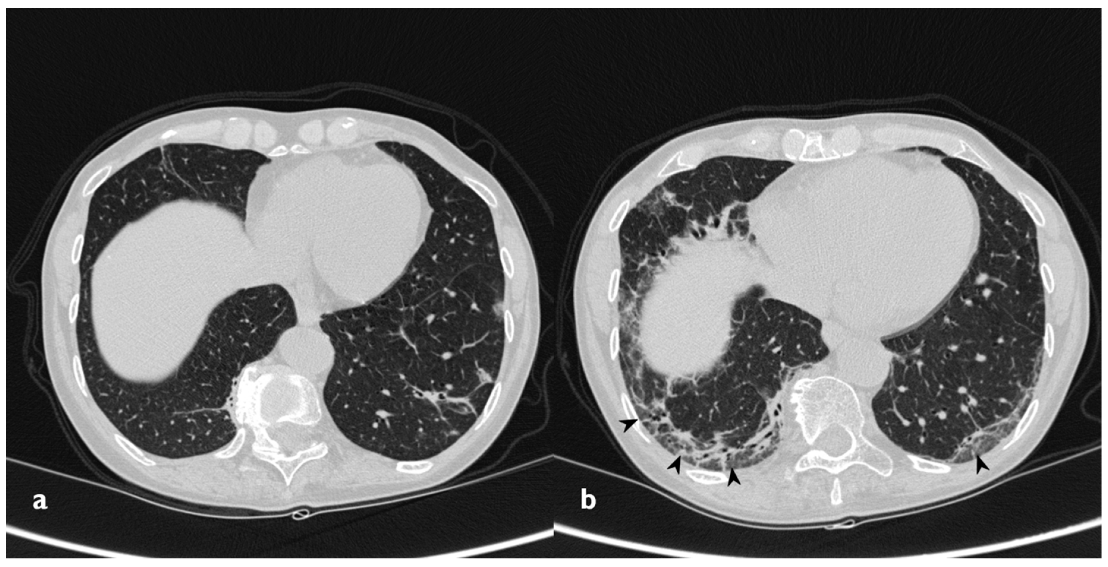 Diagnostics 10 00262 g016