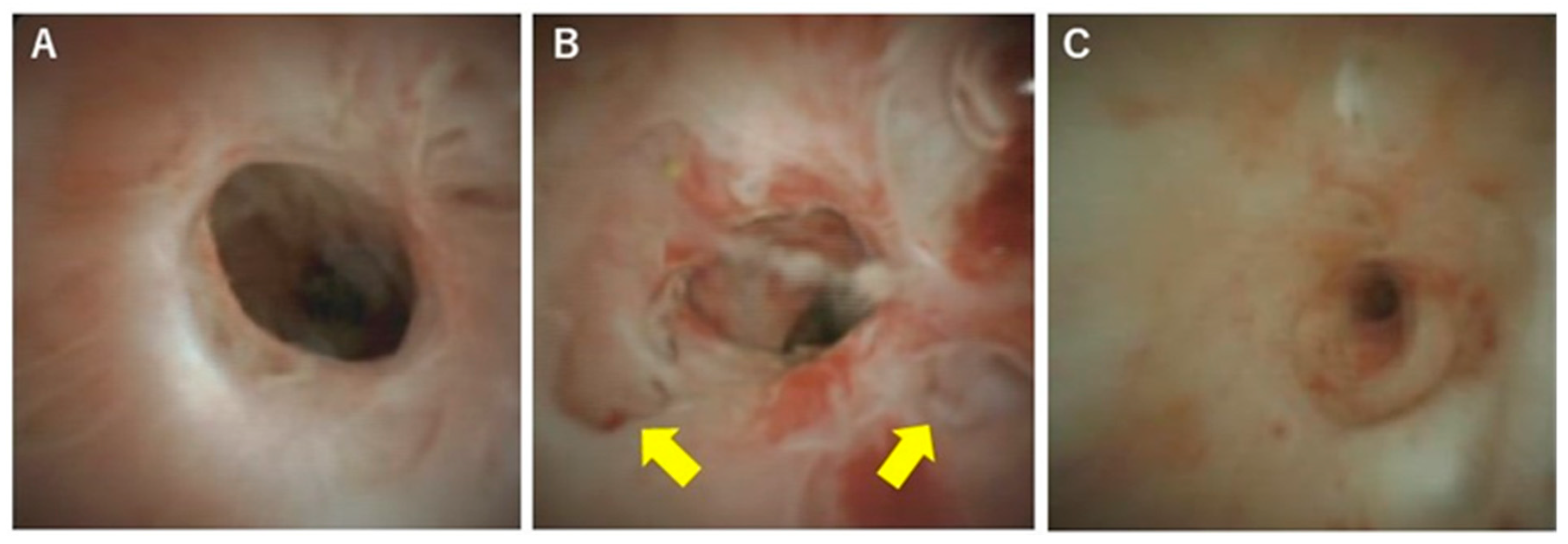 Diagnostics 10 00268 g005 Diagnostics 10 00268 g005