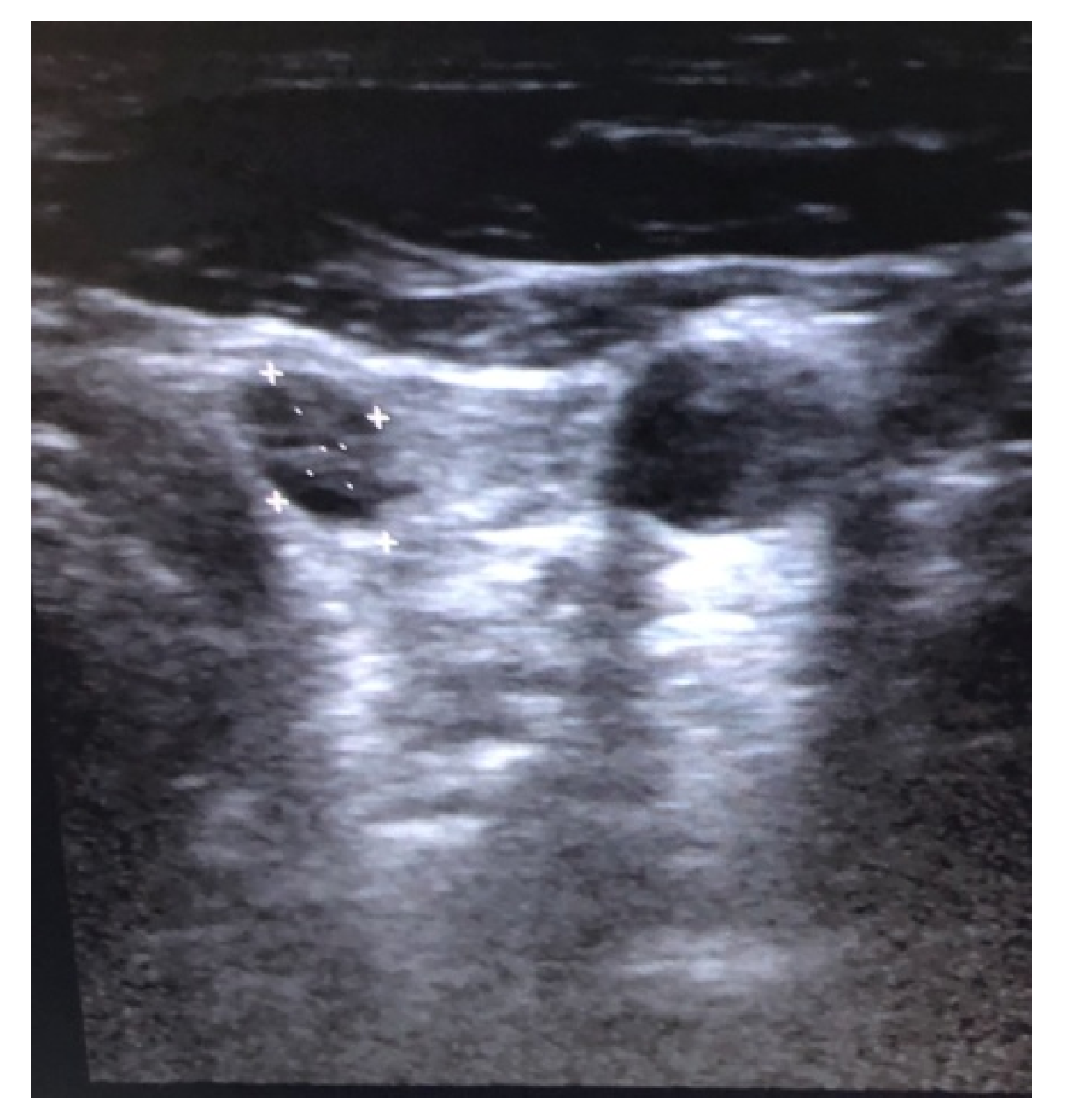 Diagnostics 10 00270 g001 Diagnostics 10 00270 g001