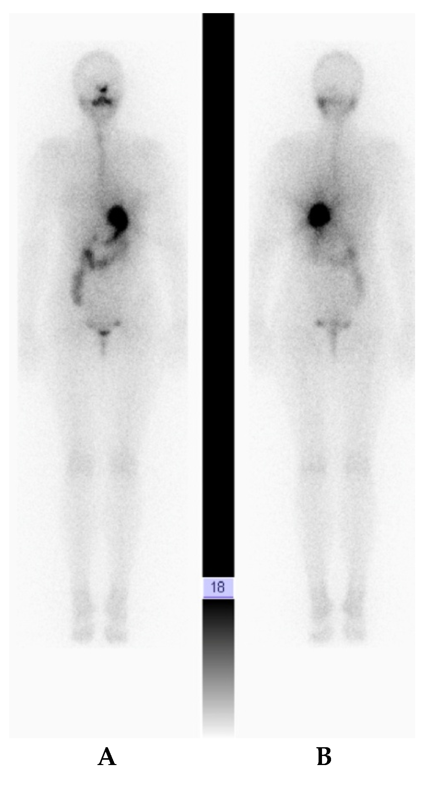 Diagnostics 10 00270 g003 Diagnostics 10 00270 g003