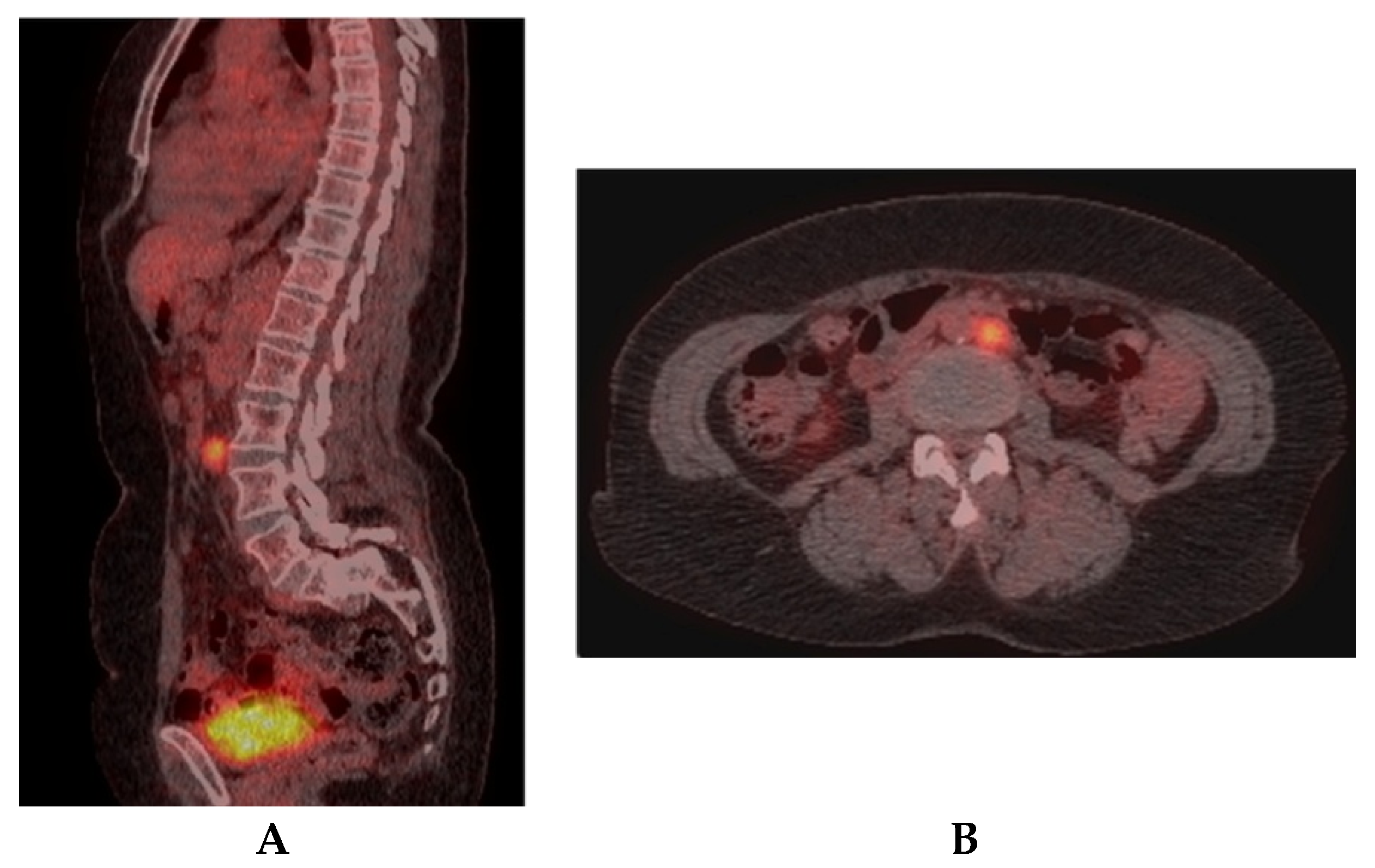 Diagnostics 10 00270 g006 Diagnostics 10 00270 g006