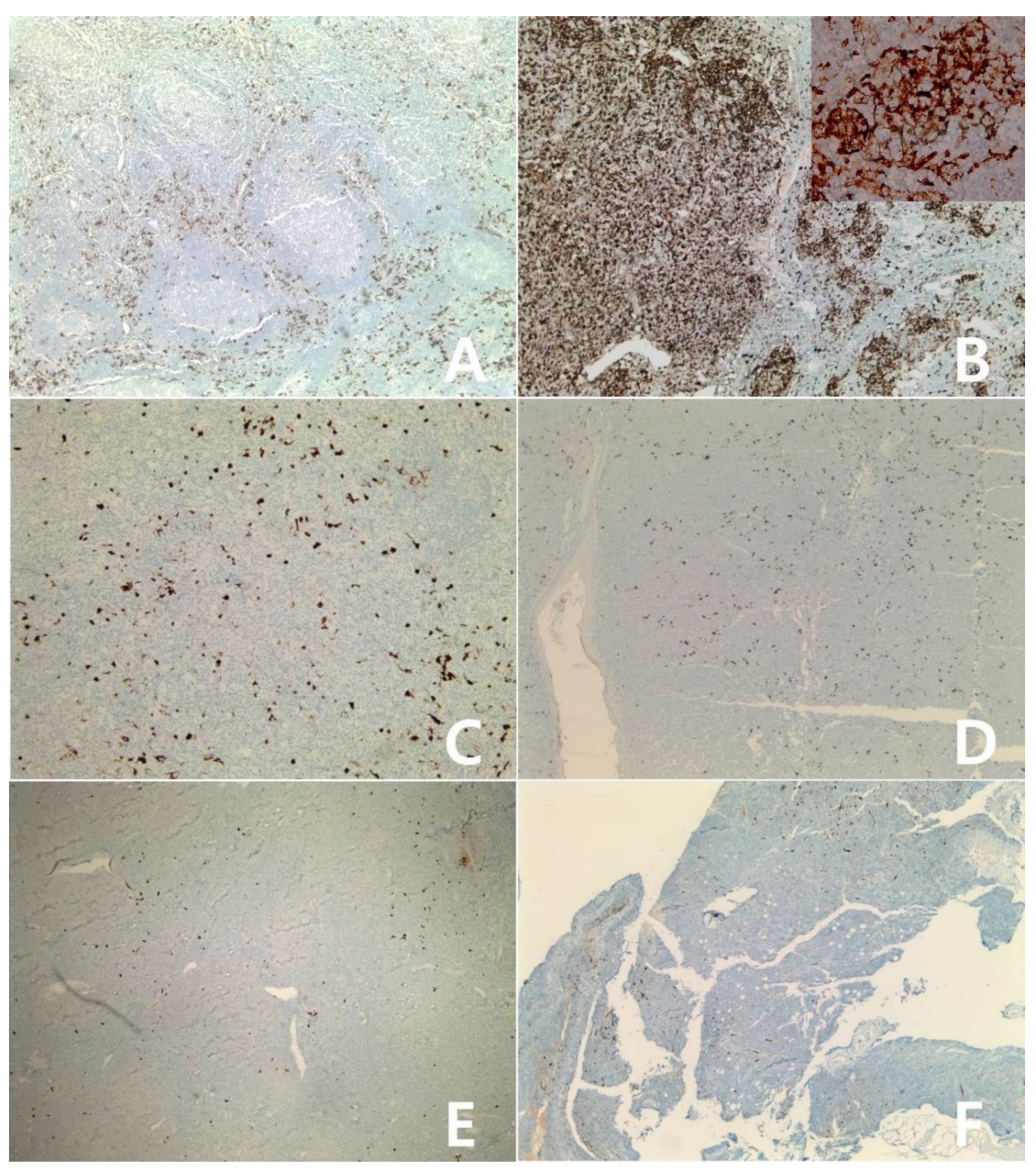 Diagnostics 10 00275 g005 Diagnostics 10 00275 g005