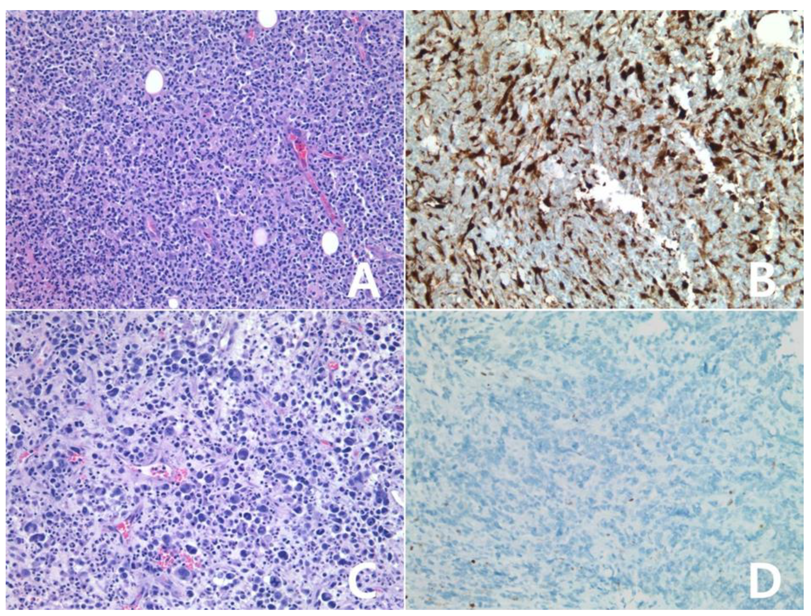 Diagnostics 10 00275 g010 Diagnostics 10 00275 g010