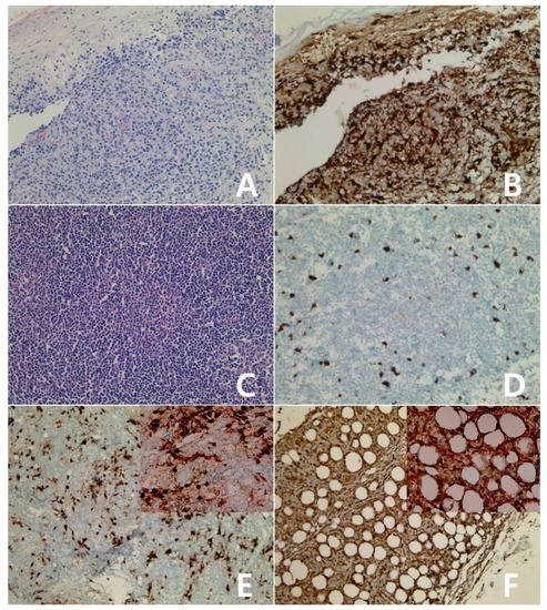 Immunohistochemical Features of Indoleamine 2,3-Dioxygenase (IDO) in ...