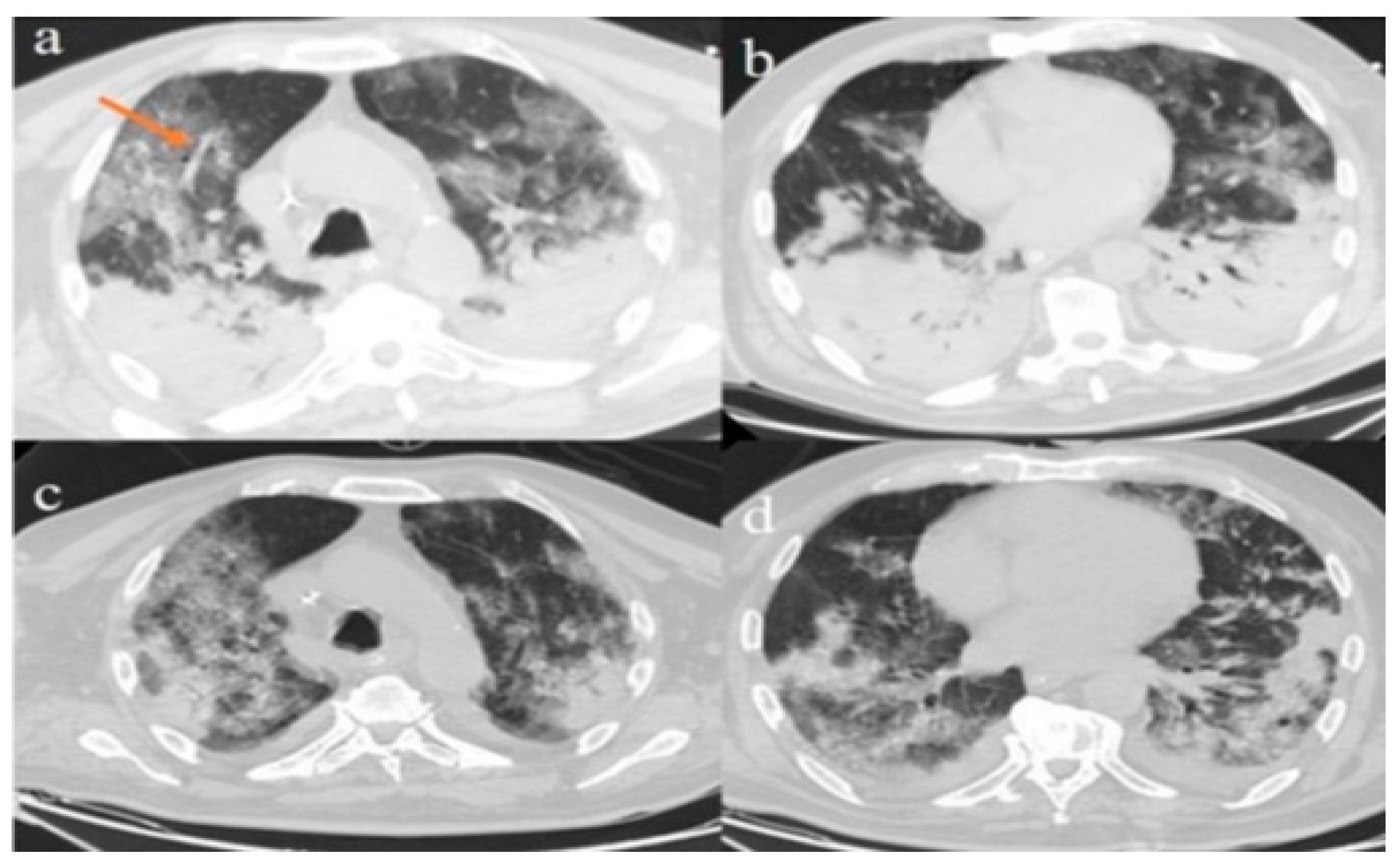 Diagnostics 10 00283 g002