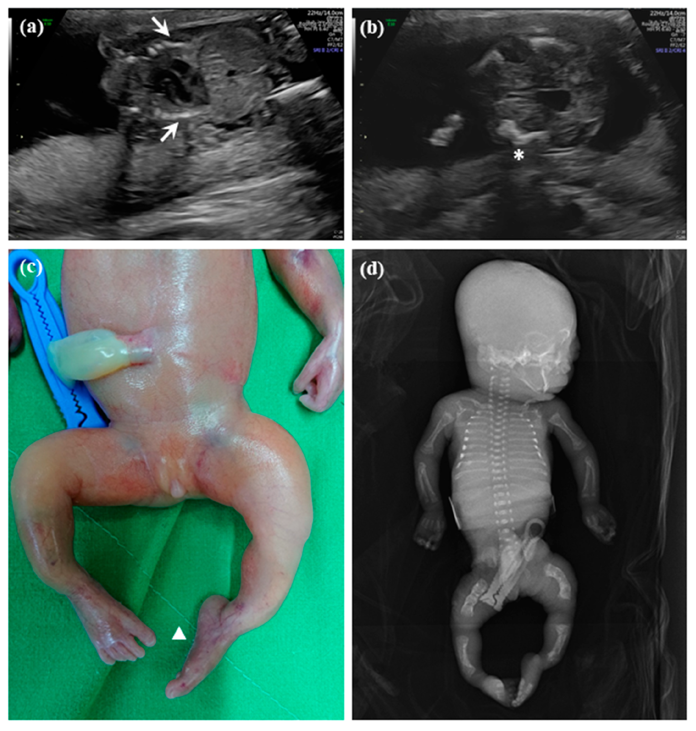 Diagnostics 10 00286 g001 Diagnostics 10 00286 g001