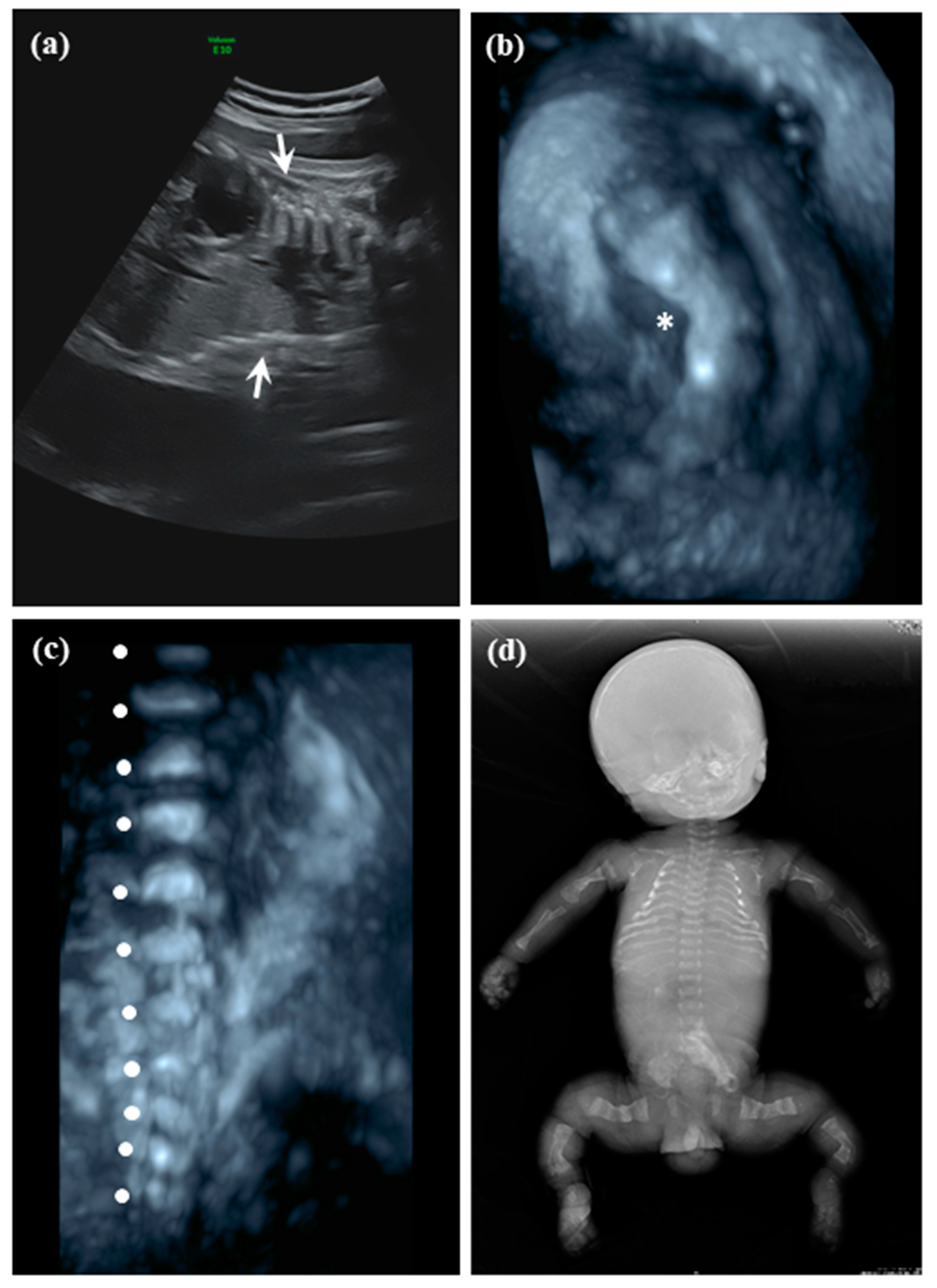 Diagnostics 10 00286 g002 Diagnostics 10 00286 g002