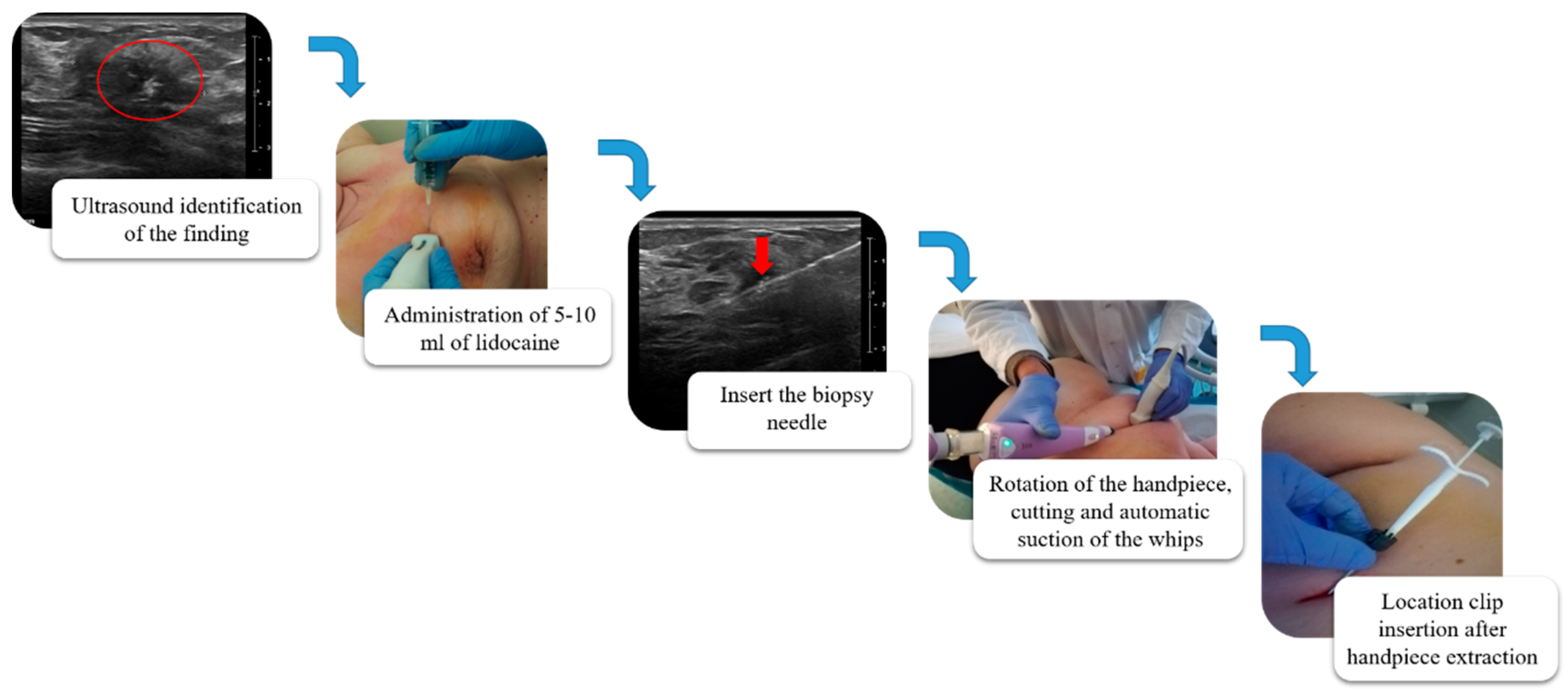 Diagnostics 10 00291 g002