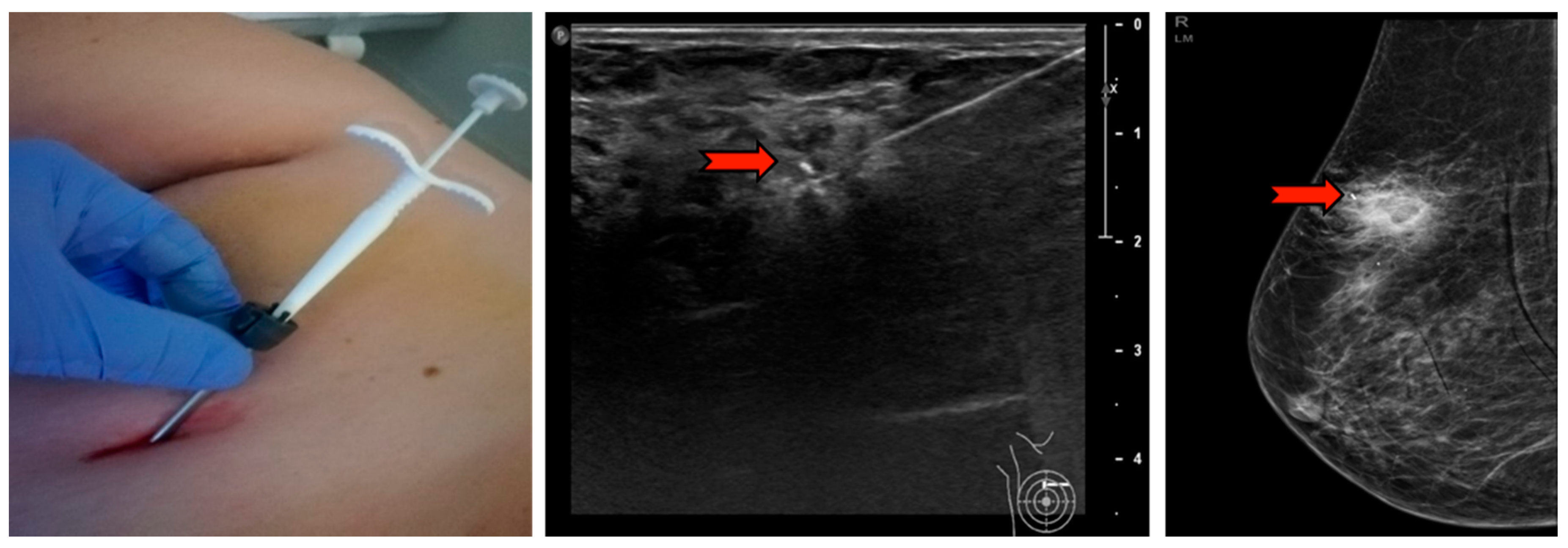 Diagnostics 10 00291 g005