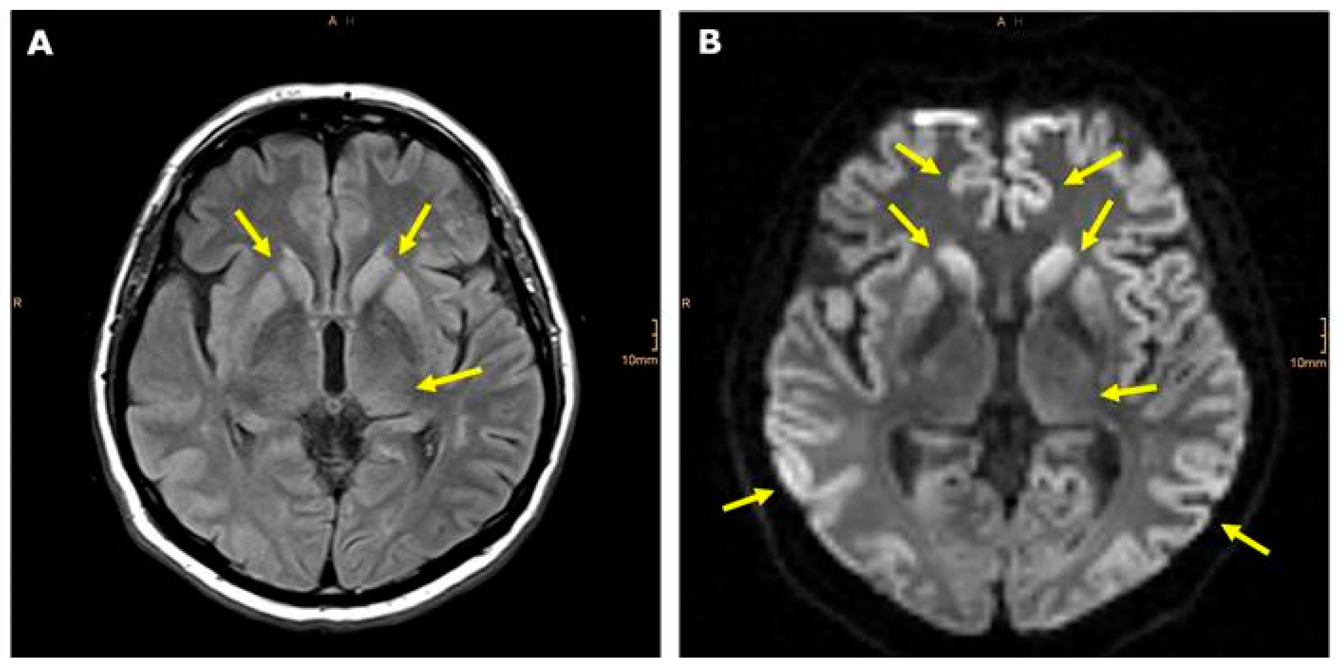 Diagnostics Free FullText Functional Resonance Imaging in