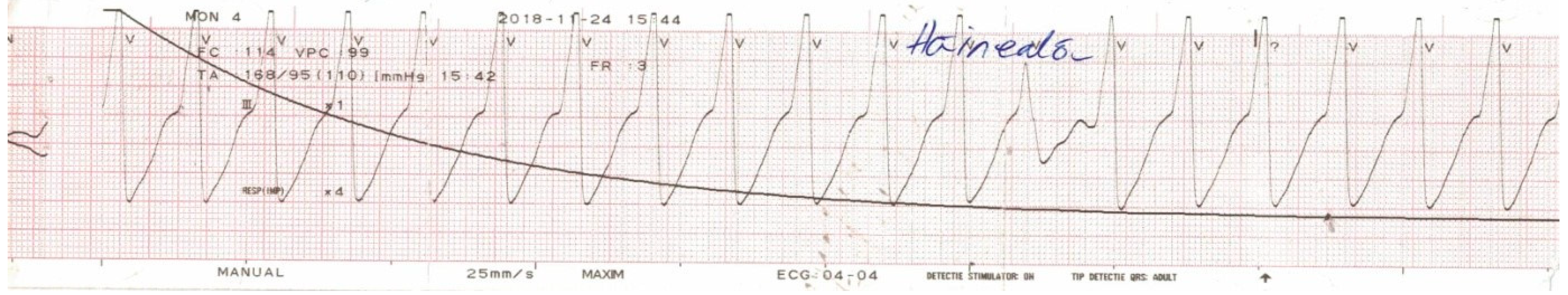 Diagnostics 10 00316 g001